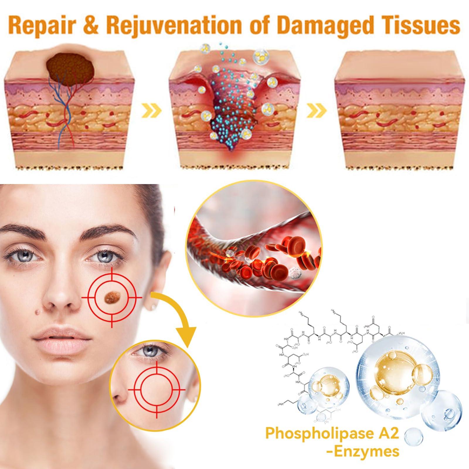 Zoencgz Bee Venom Removal Cream, New Bee Venom Treatment Cream, Professional Bee Venom Repair Cream for All Parts of The Body (4 Pack)