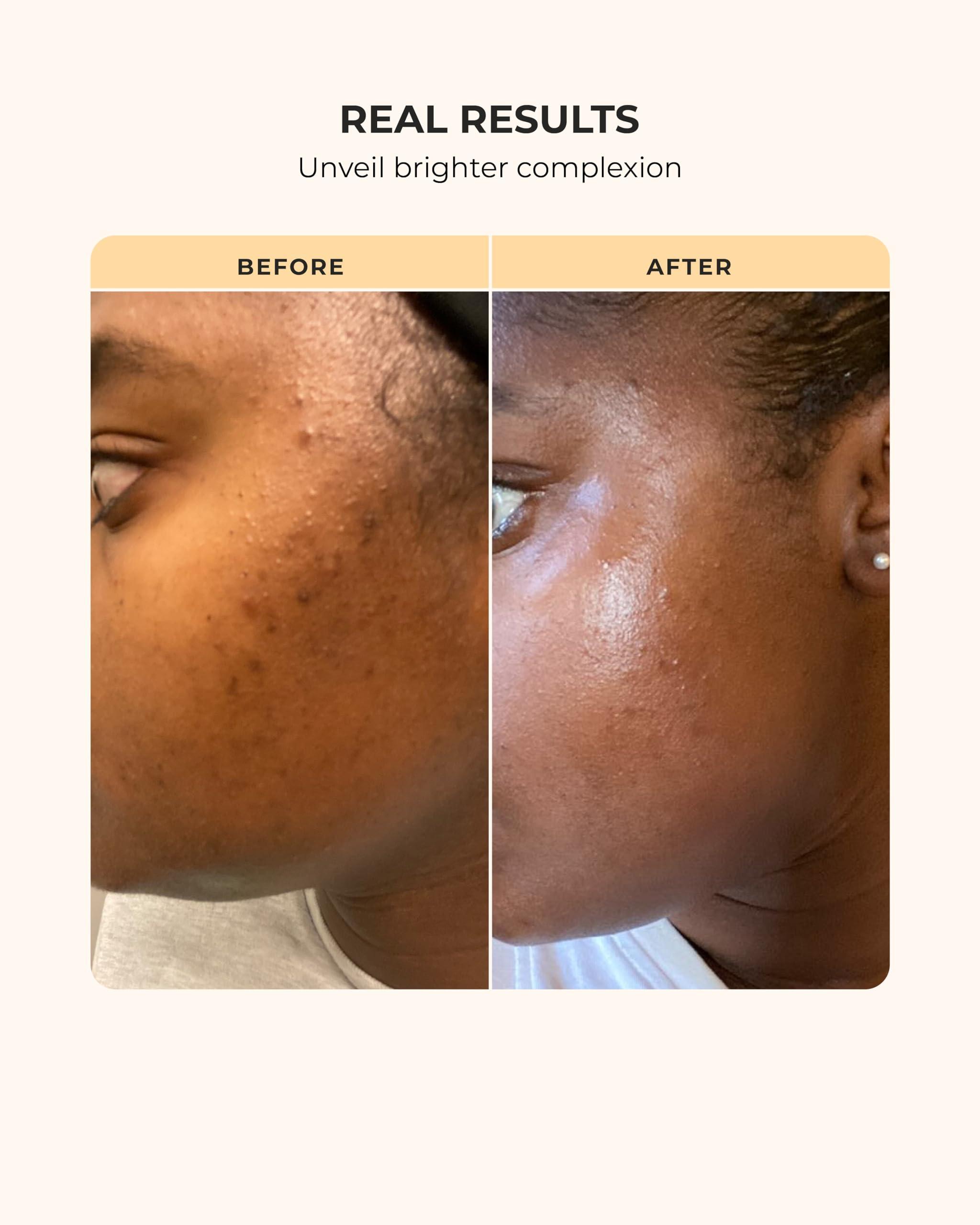 buttah. by Dorion Renaud Buttah Skin Supreme Kit for Melanin Rich Skin | CocoShea Revitalizing Cream 2 oz | Vitamin C Serum 1 oz | Cleanser 3.4 oz | Rosewater Toner 3.4 oz | Black Owned Skincare