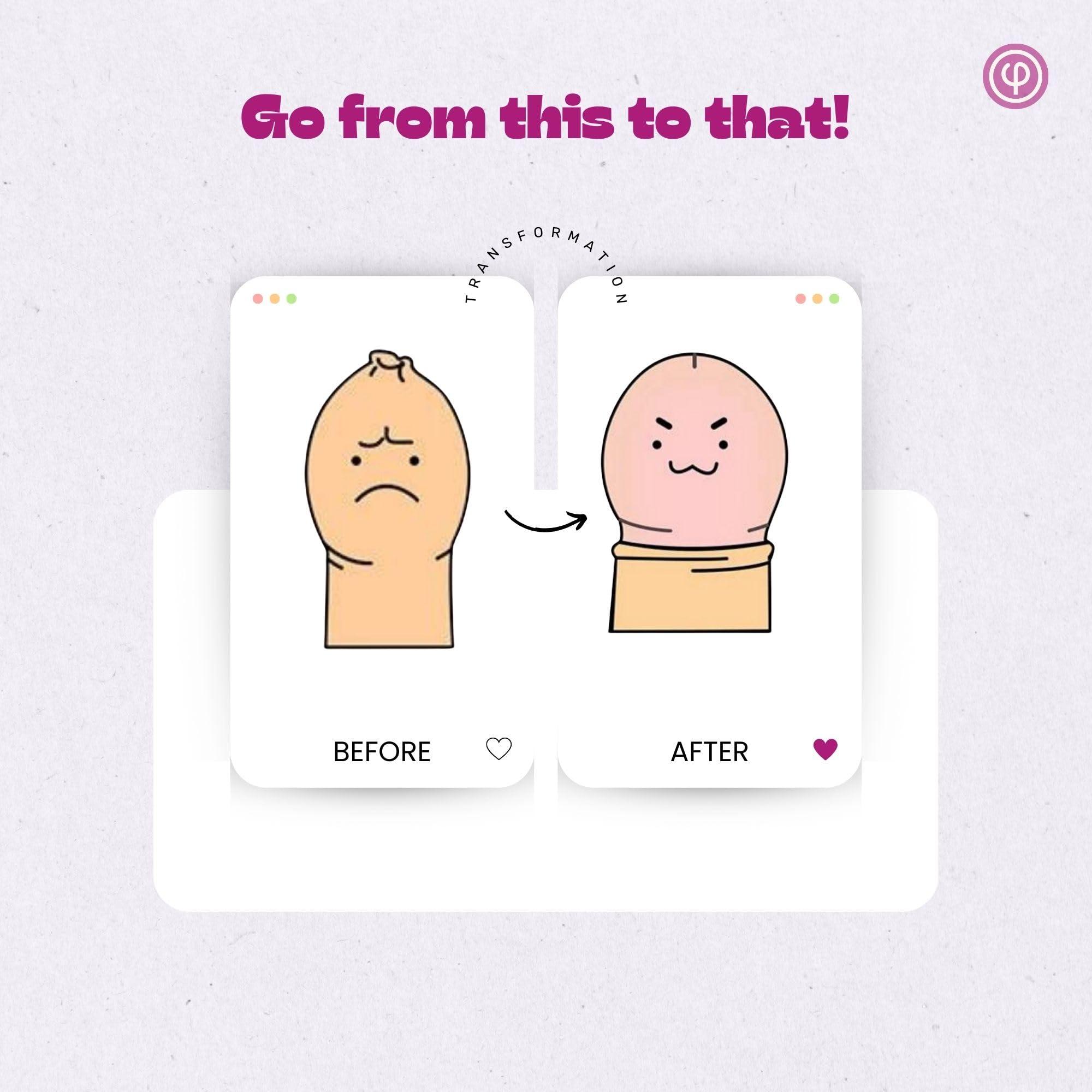 VAJRAANG Vajraang Phimosis Stretching Rings Kit, Ring Removal Tool And User Manual | Includes 20 Graduated Rings | Fast Results | No-Side-Effects (With Phimosis Cream)