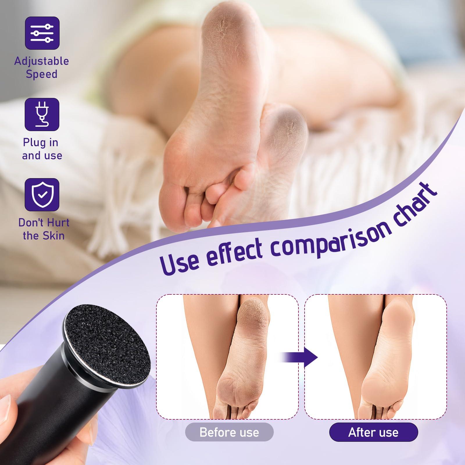 krofaue krofaue Electric Callus Remover - Electronic Foot File Grinder with Speed Controller and 60PCS Replacement Sandpaper Disk Professional Pedicure Tool for Men Women Feet Dry Dead Skin Black