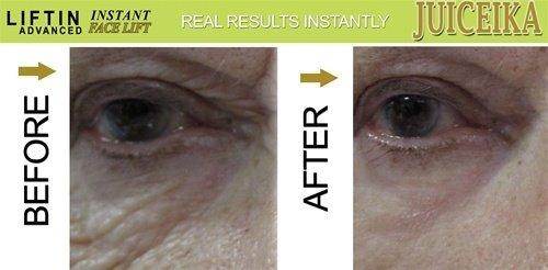 Juiceika "LIFTIN Advanced" INSTANT FACE LIFT by Juiceika. This is an INCREDIBLE 60 Second FACE LIFT!