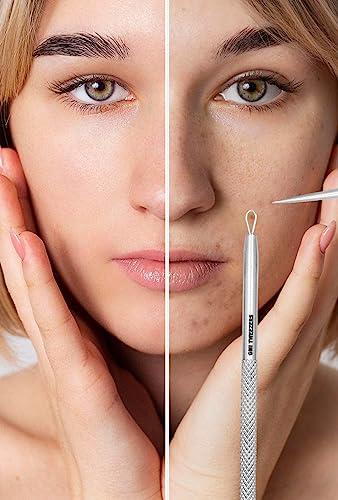 GMI-TWEEZERS GMI-TWEEZERS Blackhead Remover- 5 Piece Blackhead Extractor Tools Set for Pore Vacuum Extraction- Professional Grade Facial Cleaning & Blemish Removal- Blackhead Extractor Tools.
