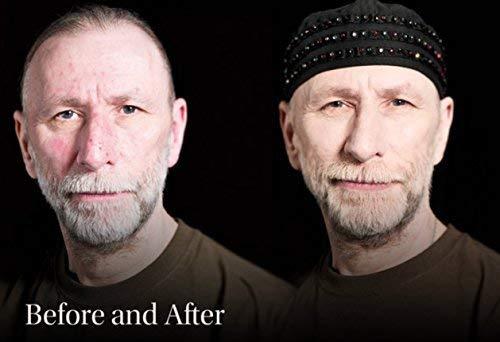 Keromask Keromask Full Coverage Concealer | Dark No 3 | Camouflage Makeup | Waterproof Concealer | Hypoallergenic | Vitiligo, Tattoo, Rosacea, Tattoo Cover |24 Shades