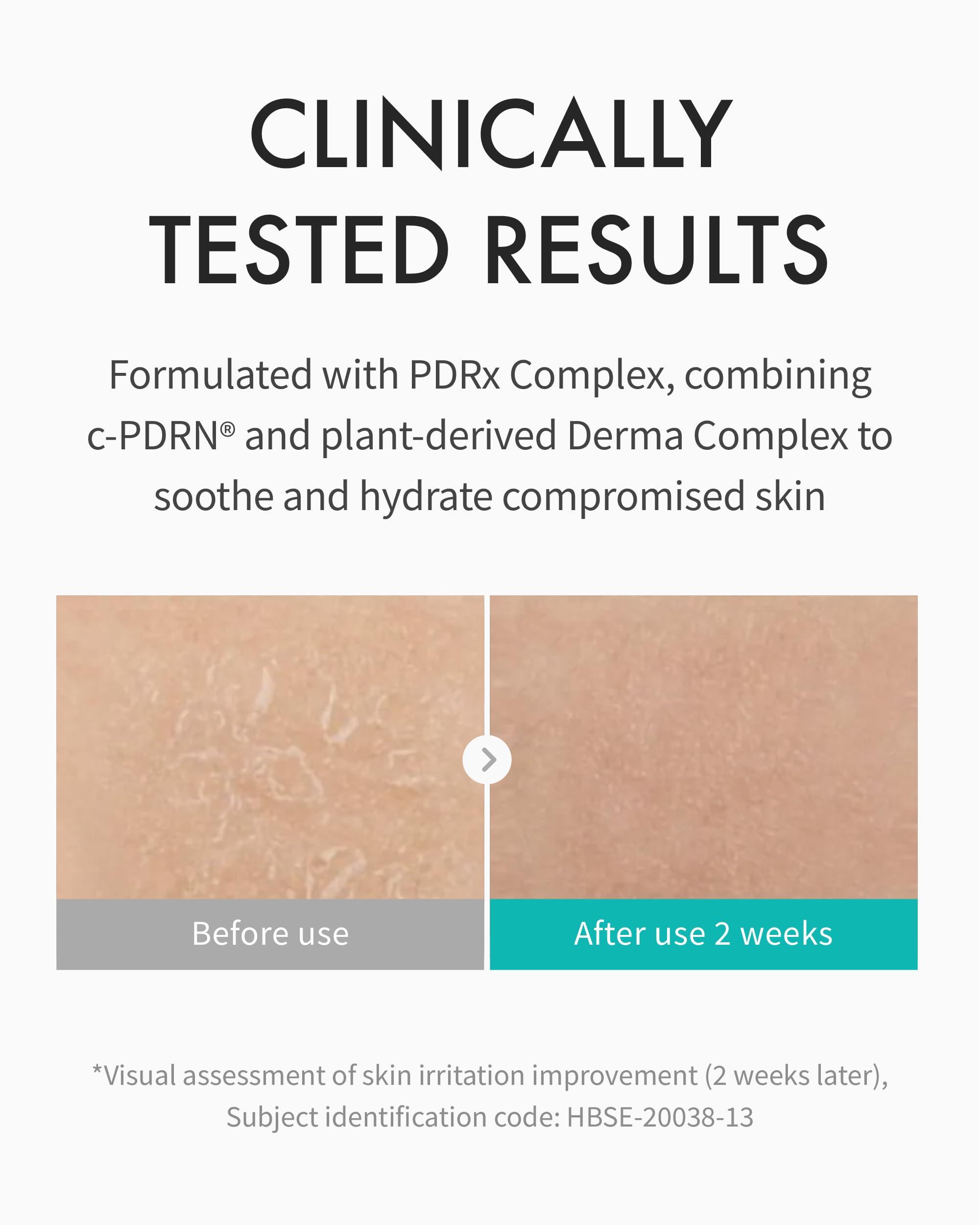 REJURAN REJURAN Moisture Cream, c-PDRN - Daily Moisturizer for Long-Lasting Hydration and Skin Barrier Support with PDRx. (2.11 oz)