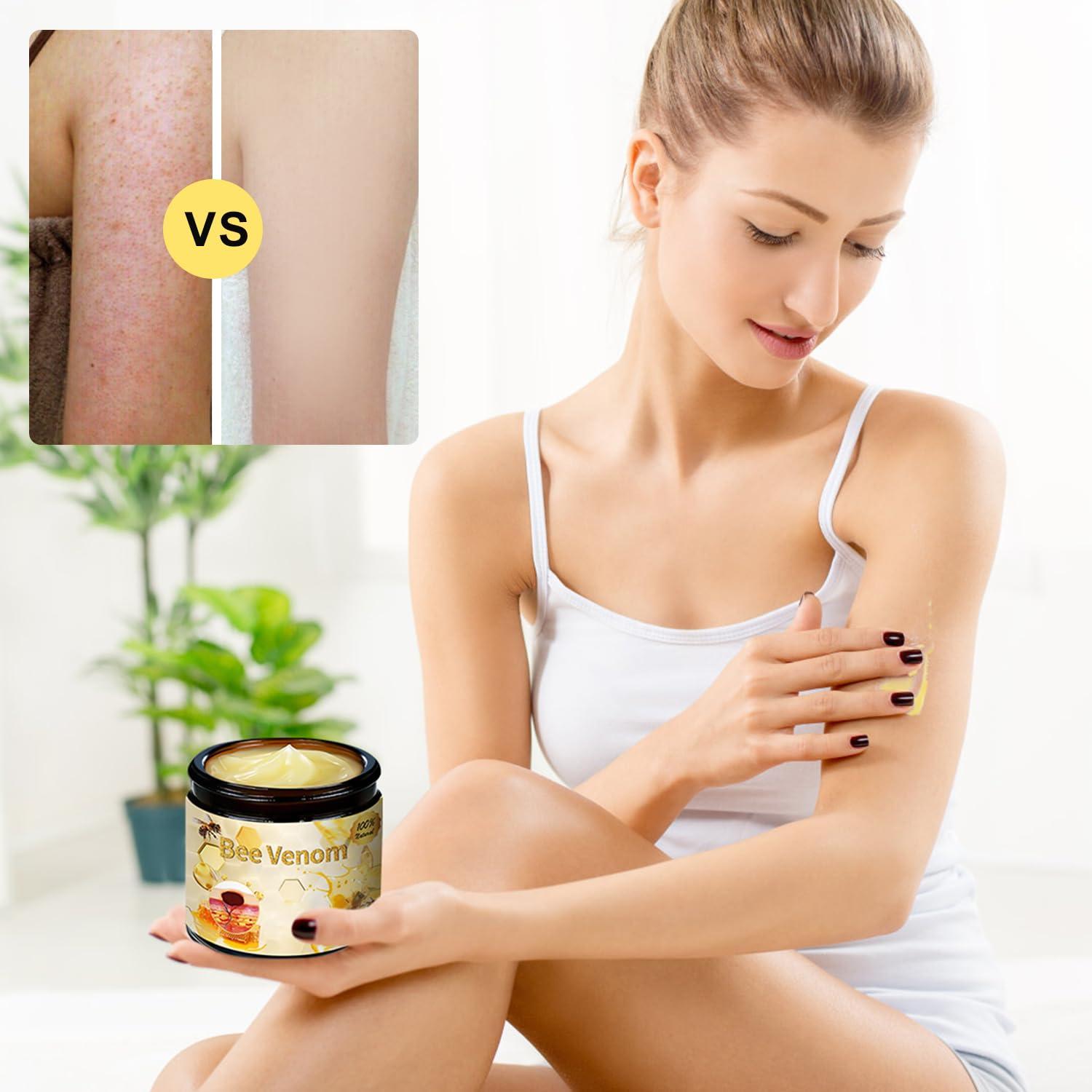QiFind Bee Venom Cream, New Bee Venom Skin Treatment Cream, Professional Natural Bee Venom Repair Cream Gel, Bee Venom Skin Cream for All Parts of The Body (2 Pack)