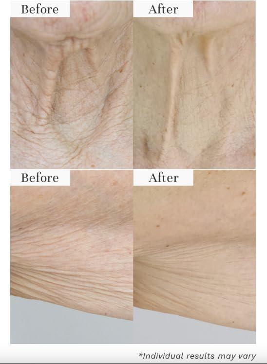 City Beauty City Beauty InvisiCrepe Body Balm - Skin Firming & Tightening Lotion for a Smoother, Firmer Look | Anti-Aging Firming Body Lotion & Body Cream