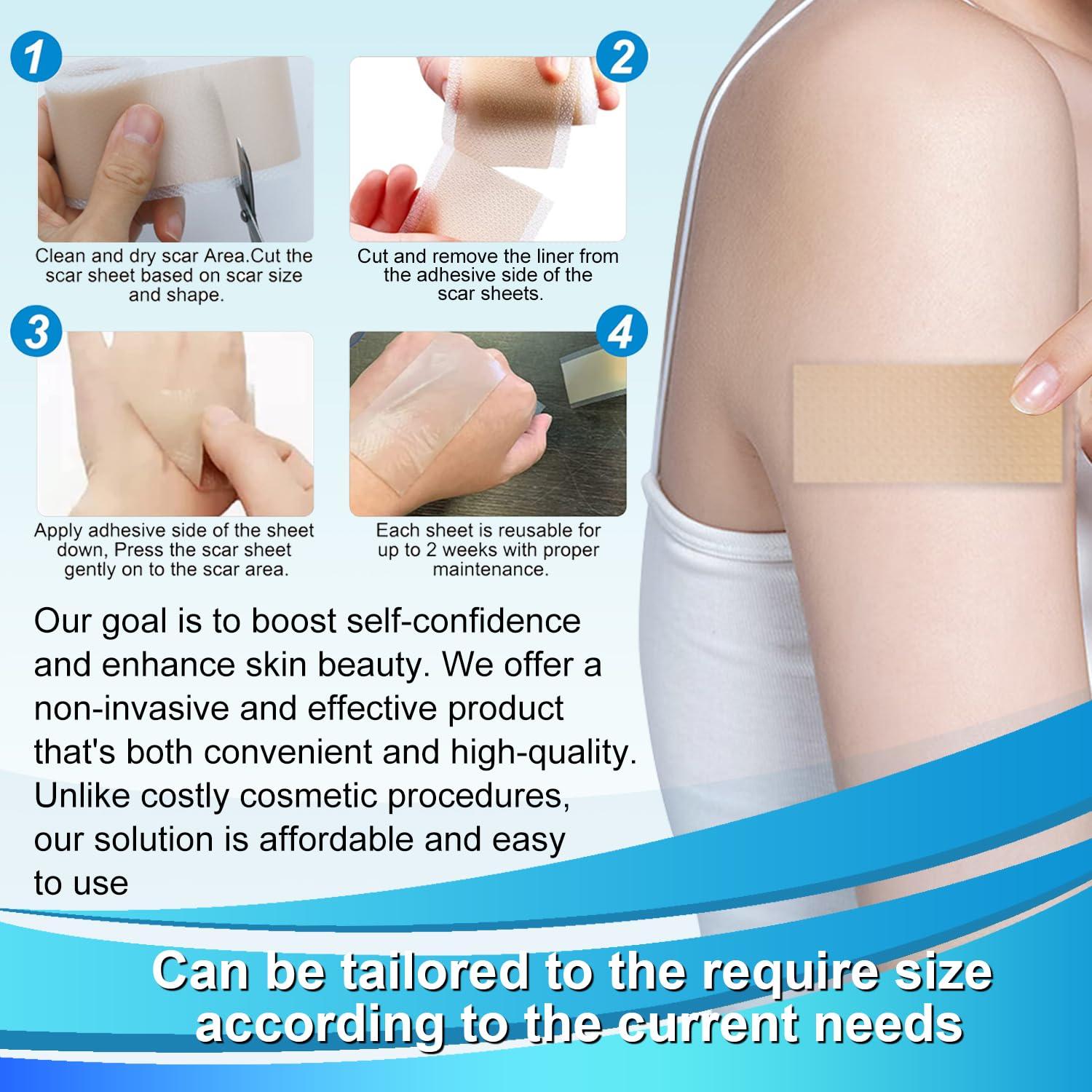 Hysimedy Medical Grade Silicone Scar Tape for Surgical Scars (1.6\" x 120\" - 3M) Professional Silicone Scar Sheets Scar Treatment for Face Wrinkles, C Section Recovery, Keloid Bump Removal Silicone Scar Patches