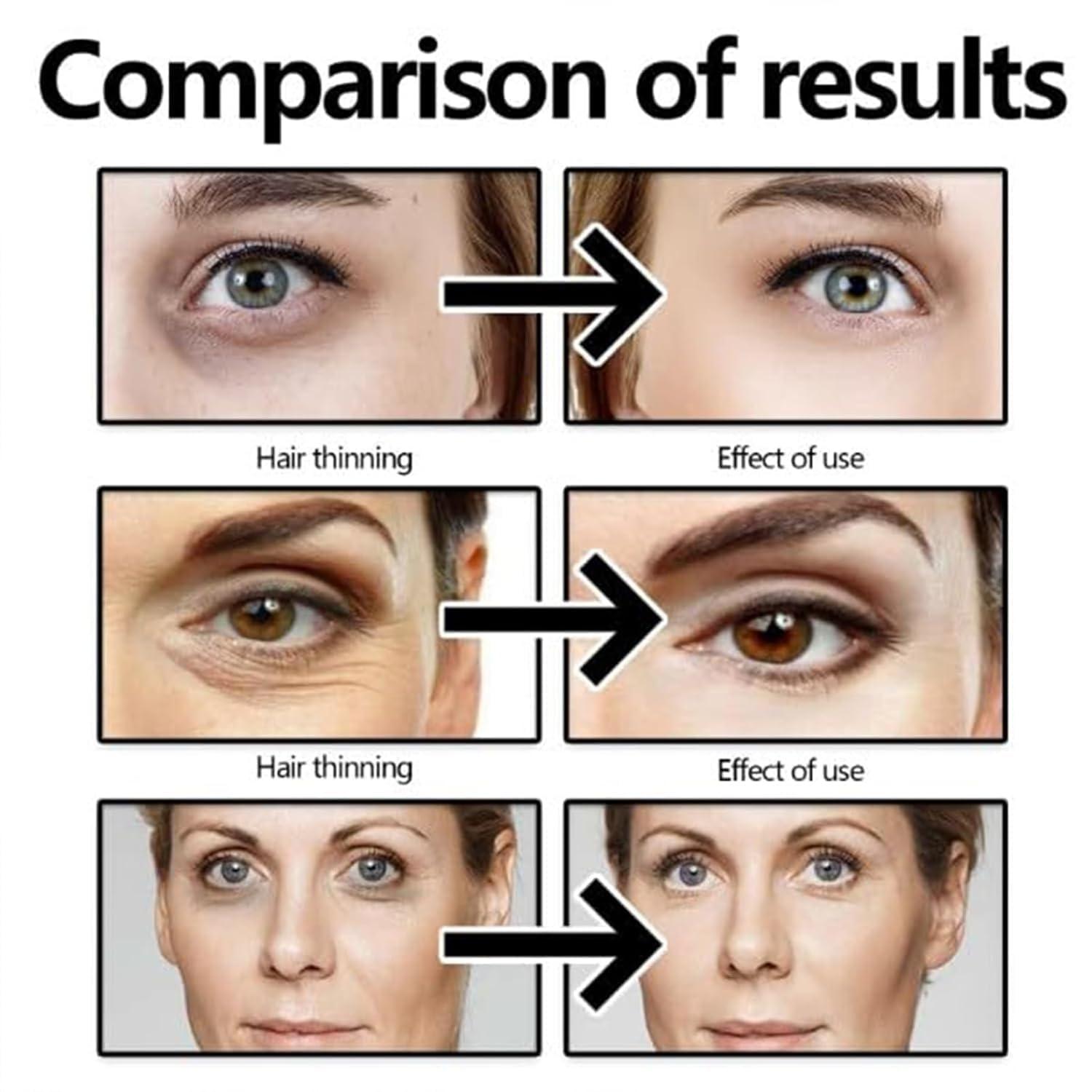 Kubot Harvey Ross Instant Lift Eye Cream, Harvey Ross effective Instant Eye Lift, Multi Action Firming Under Eye Cream, Under Eye Cream for Puffy Eye Bags Fine Lines, Specializes in Lifting The Eye Area