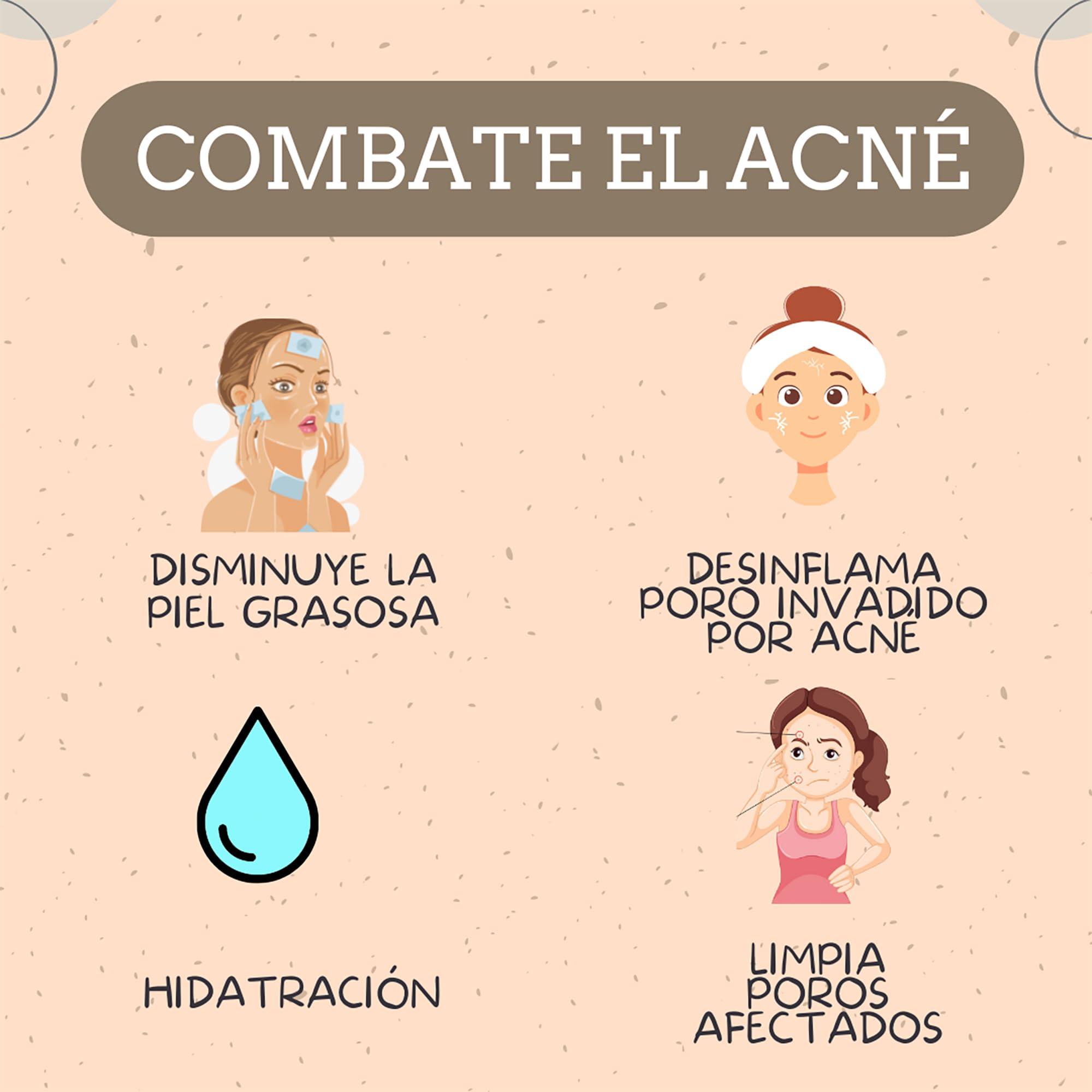 Bella Piel PINK MOSQUETTE ANTI-ACNE CREAM