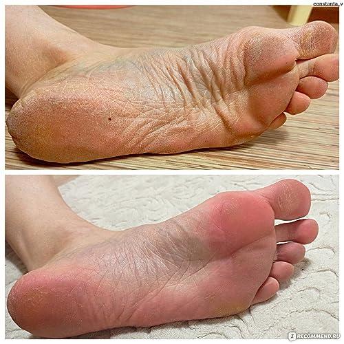 RIGHTMELL Natural Foot Soak Salt - Foot Treatment Soothes Athletes' Feet, Relieves Foot Odor and Ttchiness -9 Ounce