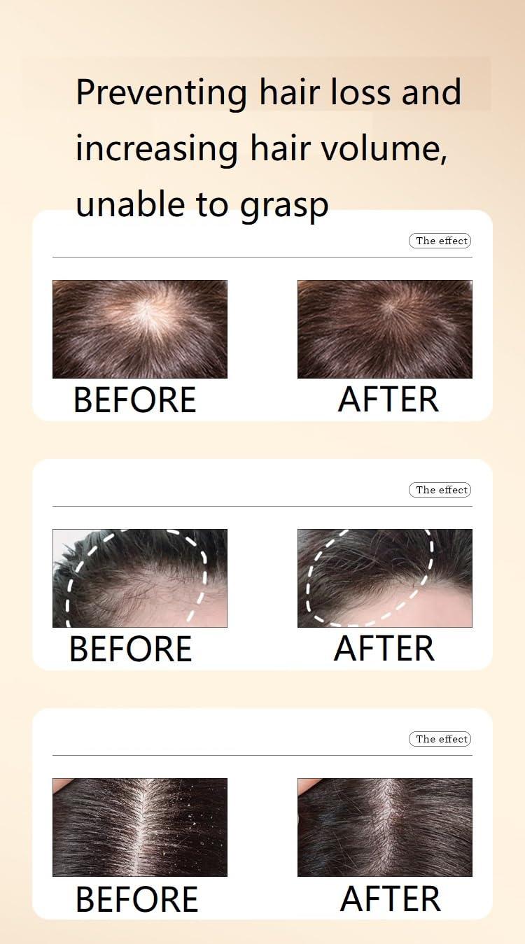 Ginaday 2 Box Ginger Plant Extract Shampoo for Hair Growth and Anti-Loss Control, Hair Growth Oil Care by Ginaday