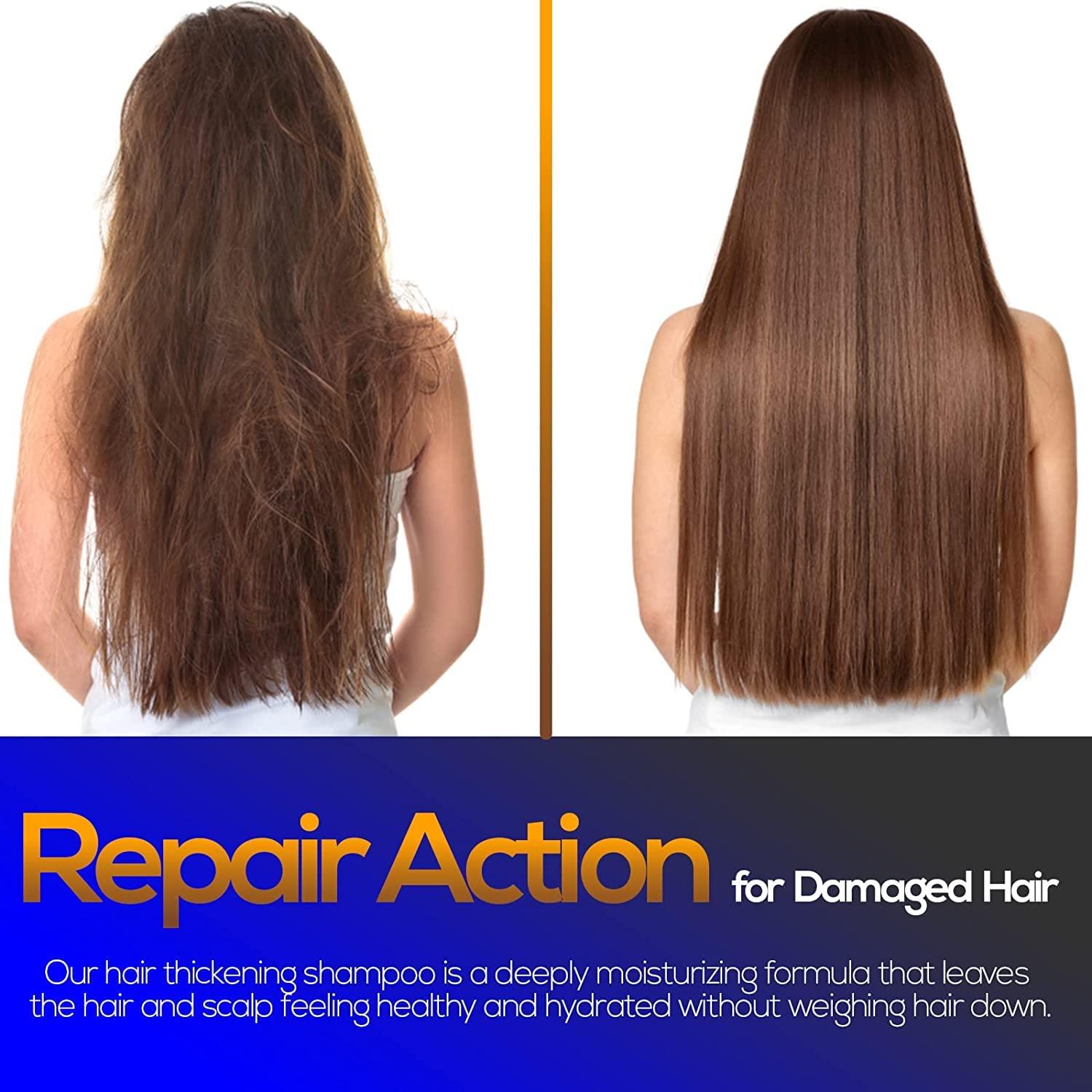 Ammuri Ammuri Biotin Hair Growth Shampoo & Conditioner - DHT Blocker, Anti-Dandruff, Hair Loss & Hair Thickening Shampoo for Oily Hair - Promotes Hair Growth