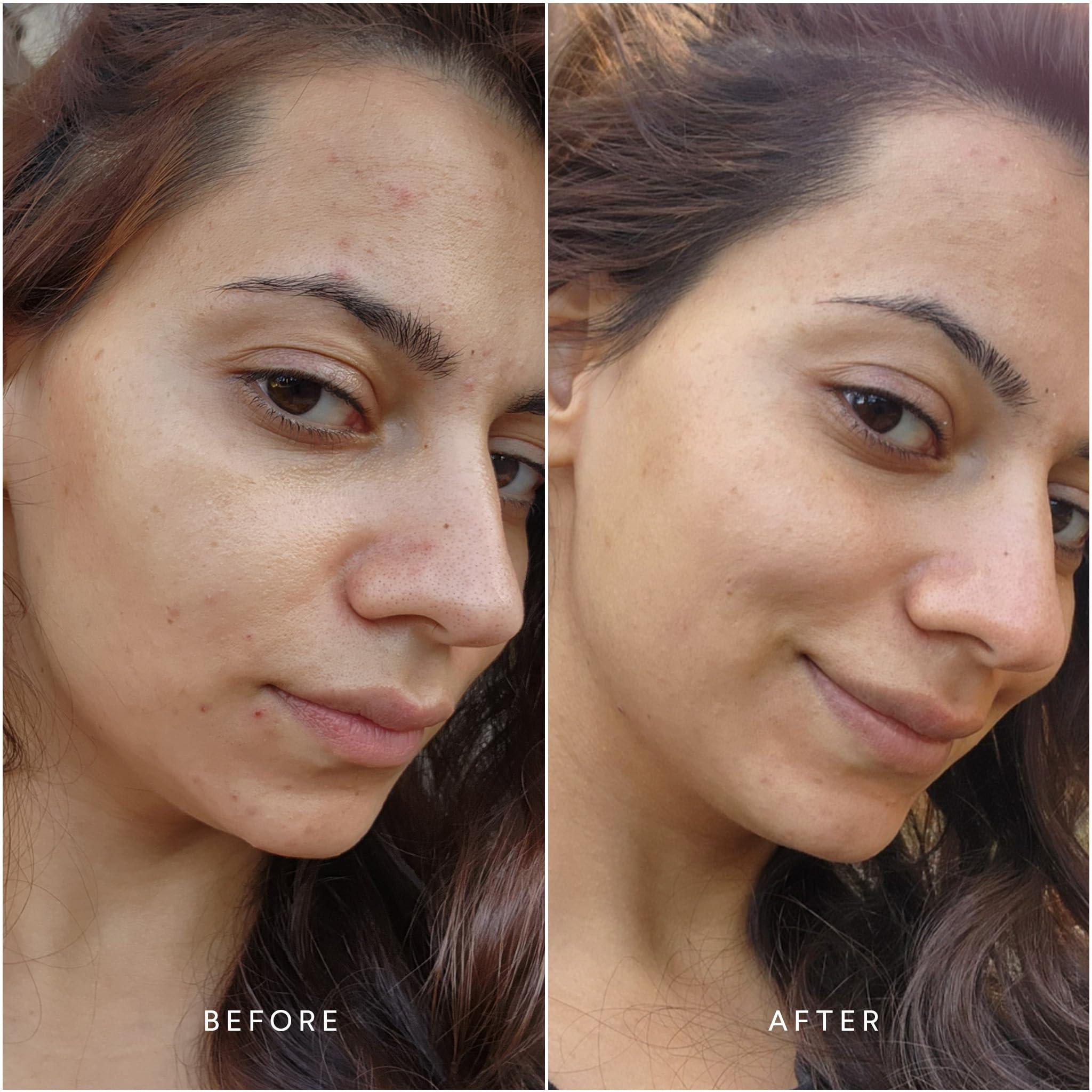 True Botanicals True Botanicals Anti-Aging Essentials | Increase Hydration, Treat Fine Lines & Wrinkles | Contains Chebula Active Serum, Renew Pure Radiance Oil, and Phyto Retinol Advanced Clinical Cream