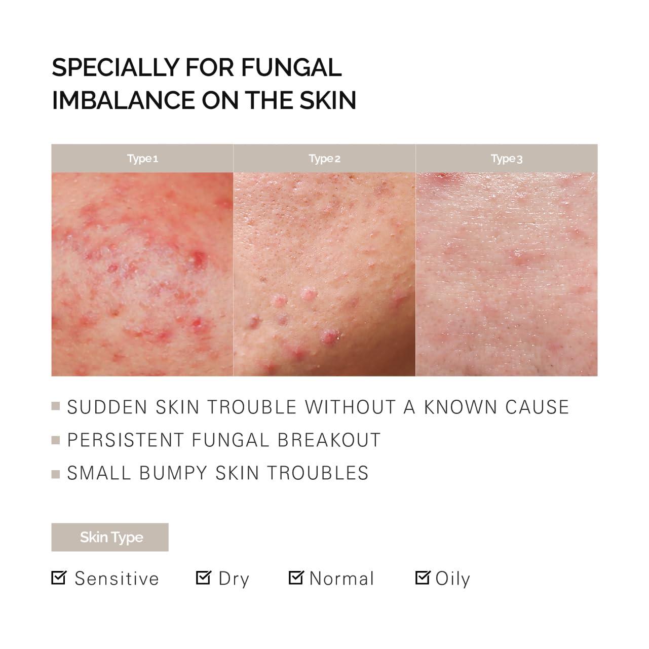 La Theorie La Theorie Cleanser Clearing Gel for troubled skin with fungal and small bumps (Fatty acid Free, 7.10 Fl Oz)