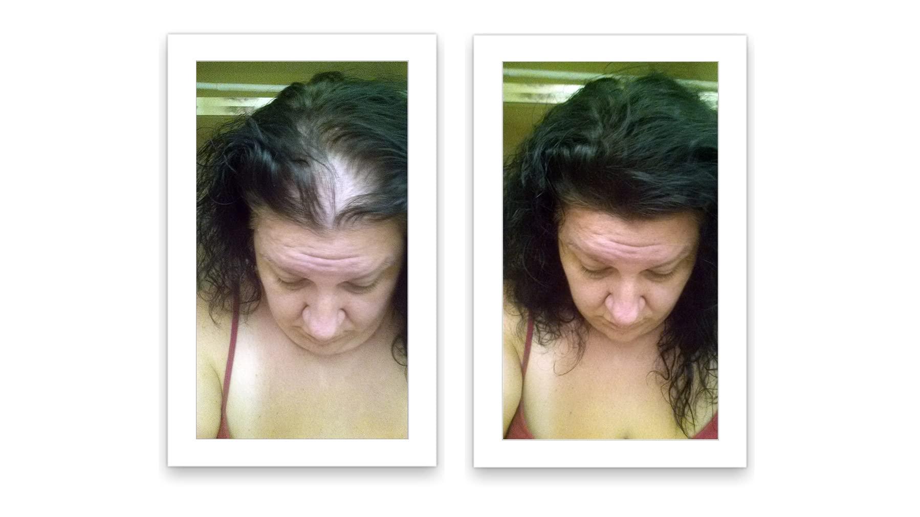 Caboki Caboki Hair Loss Concealer, All-Natural Hair Building Fiber. Make Thin Hair Look 10X Fuller Instantly. Eliminate the Appearance of Bald Spot and Thinning Hair (30G, 90-Day Supply). Black