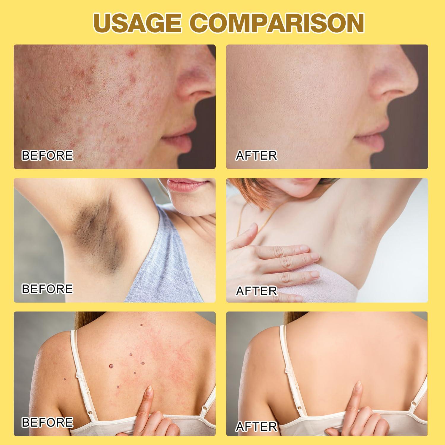 QiFind Bee Venom Cream, New Bee Venom Skin Treatment Cream, Professional Natural Bee Venom Repair Cream Gel, Bee Venom Skin Cream for All Parts of The Body (2 Pack)