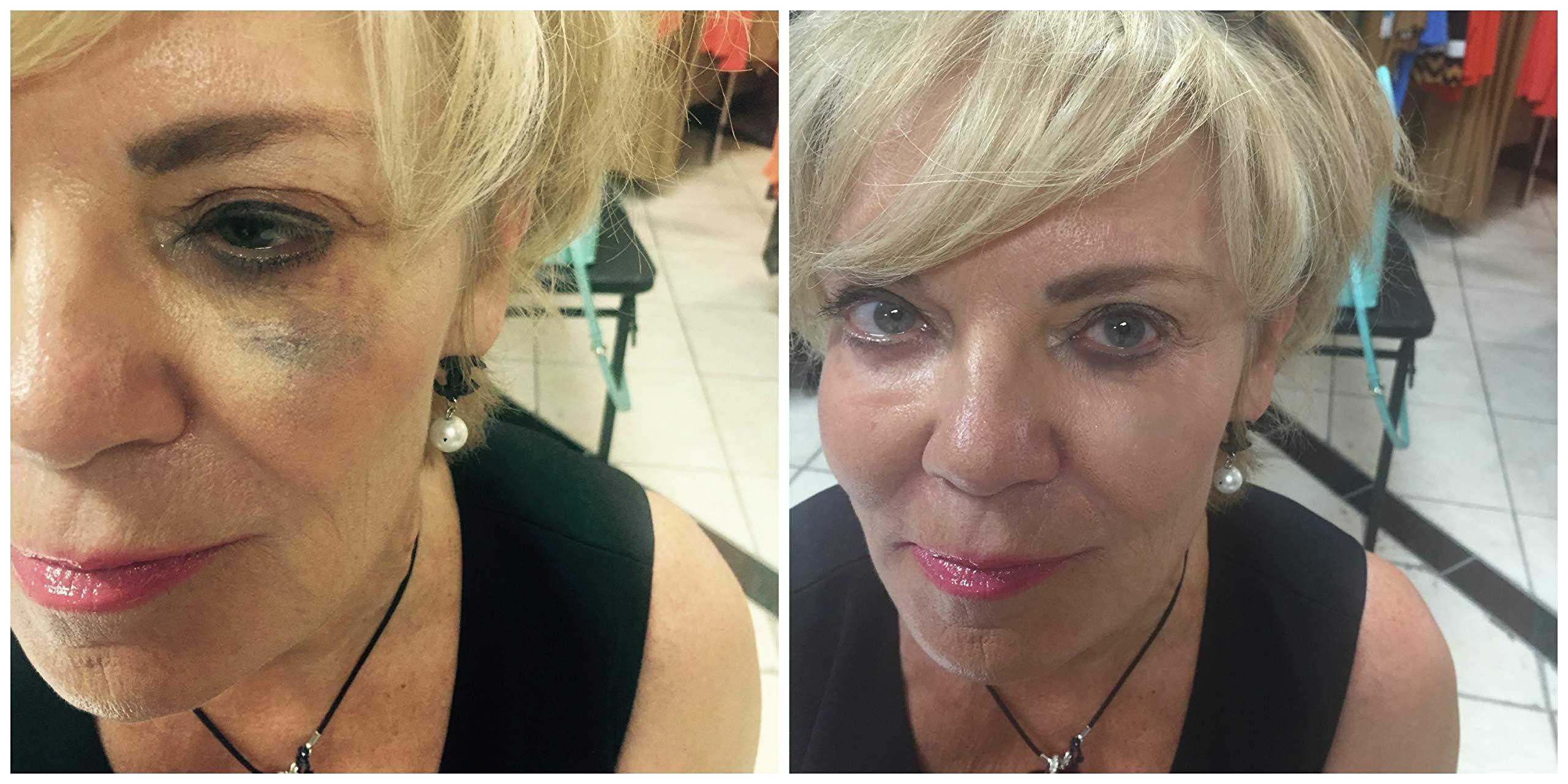 Judith August Judith August Killer Cover - Light/Medium - Cover Bruises, Tattoos, Age Spots, Vitiligo & More