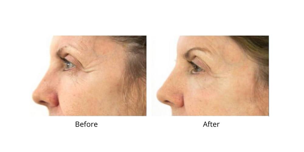 Dr.Sevinor Skincare Solutions Dr Sevinor Genuine Wrinkle Solution Wrinkle Smoothing Tinted Serum and Dr. Sevinors NEW Genuine Facelift Solution Concentrated Serum Invigorates Tired Looking Skin, Diminishes Wrinkles/Lines