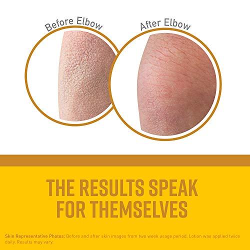 O'Keeffe's O'Keeffe's Skin Repair Body Lotion: 7 oz. Tube (Yellow)