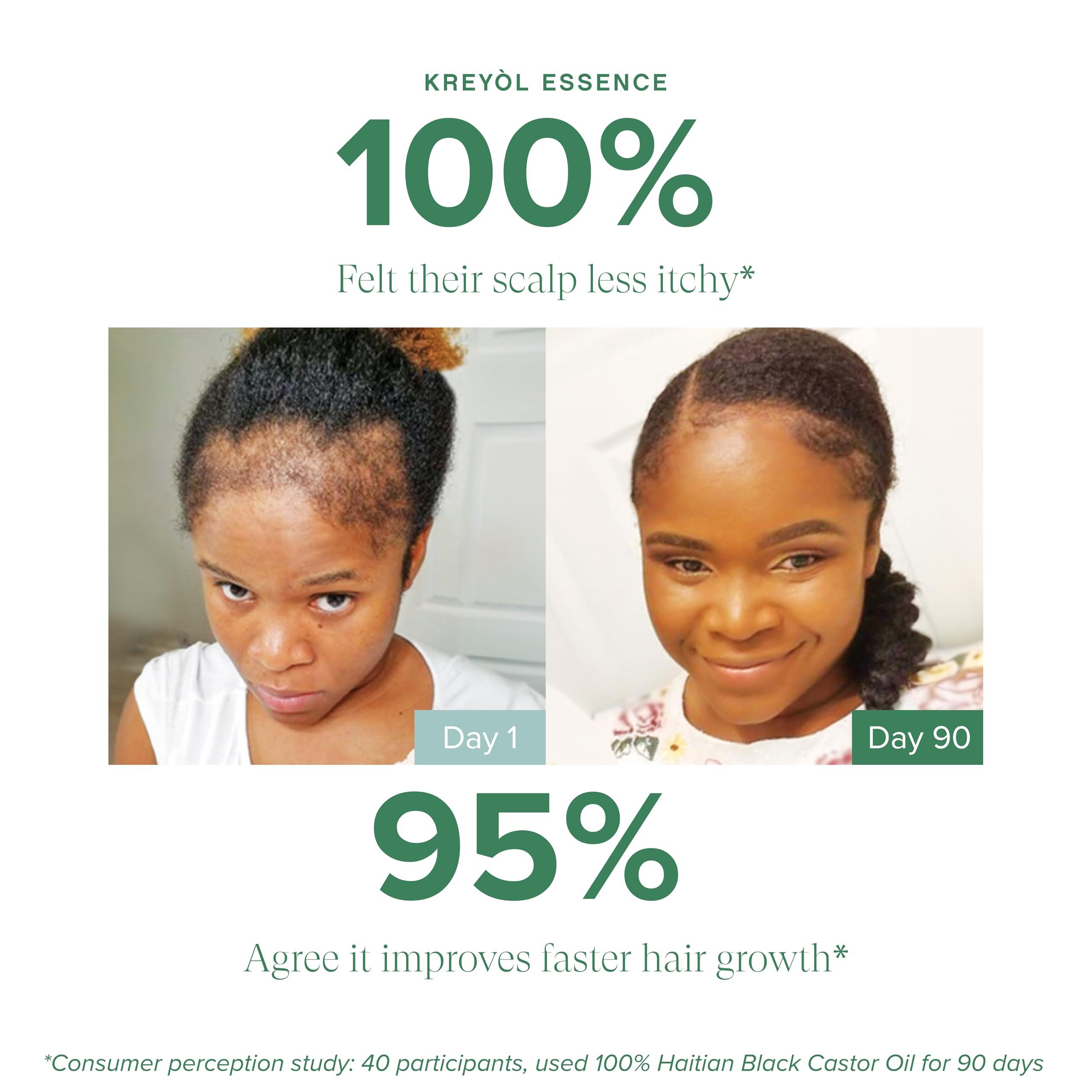 KREYÒL ESSENCE Kreyol Essence - Haitian Black Castor Oil for Skin and Hair, Glass Bottle - Fuller-Looking Hair, Pure, Hexane Free, Cold Pressed, Natural Humectant