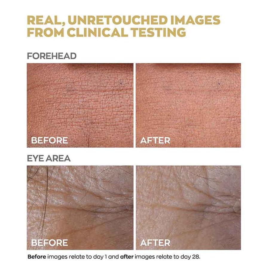 GLOWICTION Anew Protinol Power Serum 7 Signs of Ageing Powerful Results in 7 Days. Smoothes Skin, Reduces Pores and Minimises Lines for Firmer, Stronger, More Resilient, Healthier, Radiant Skin.