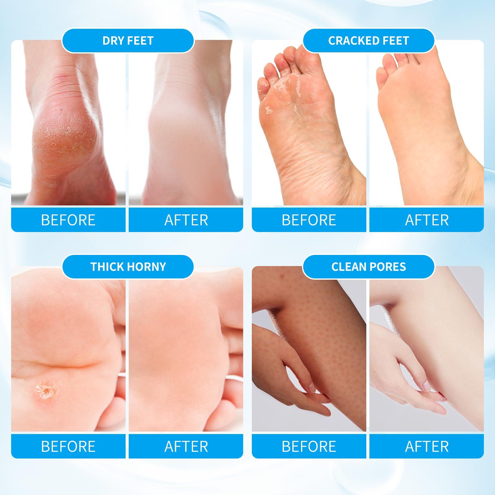 nbc BeautiLab nbc BeautiLab Pedicure Kit Foot Soak Set: Bubble Salt, Sugar Scrub, Massage Mask, Massage Lotion in a Box, 4 Step Foot Spa Kit for Dry Feet, Softens Calluses(1 Set Pacific Waves)