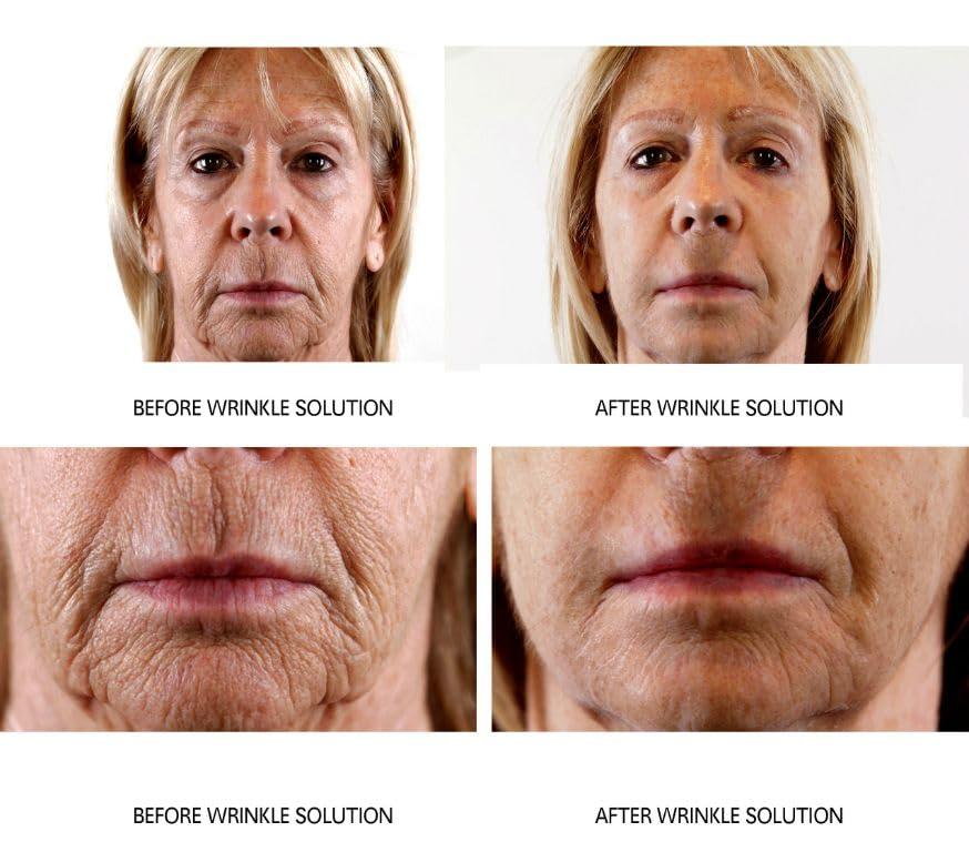 Dr.Sevinor Skincare Solutions Dr Sevinor Genuine Wrinkle Solution Wrinkle Smoothing Tinted Serum and Dr. Sevinors NEW Genuine Facelift Solution Concentrated Serum Invigorates Tired Looking Skin, Diminishes Wrinkles/Lines