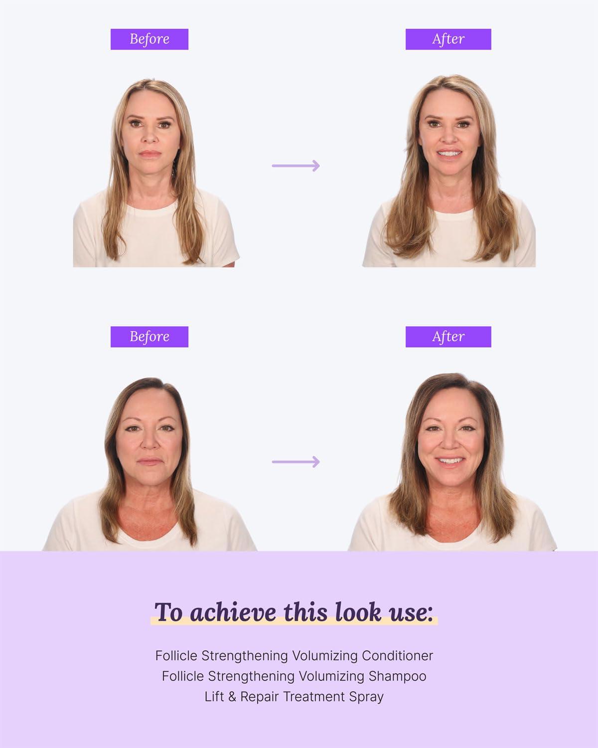 Keranique Keranique Volumizing Keratin Conditioner for Thinning Hair, Hair Regrowth | Keratin Amino Complex, Free of Sulfates, Dyes and Parabens, 8 Fl Oz