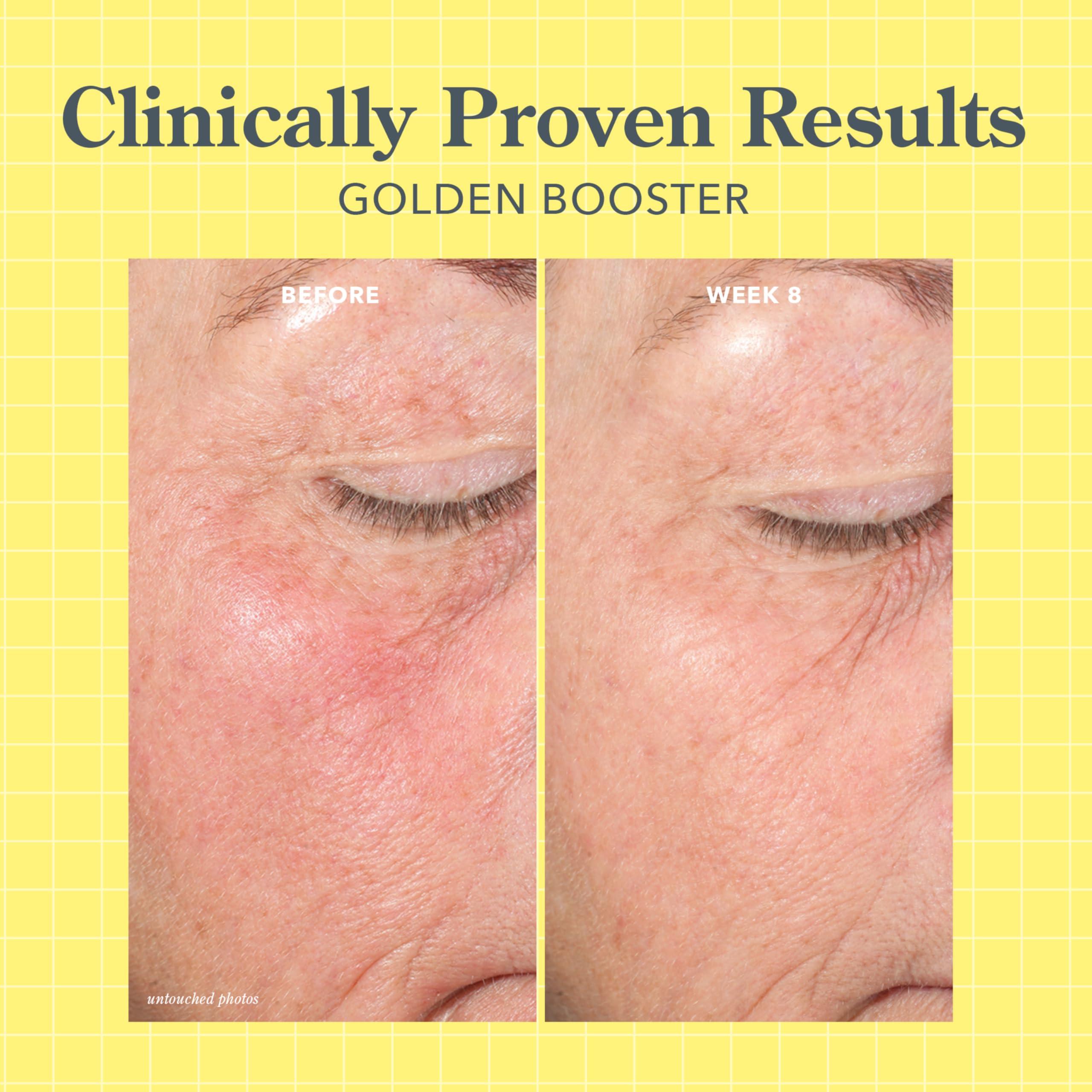 Beekman 1802 Beekman 1802 Golden Booster Amla Berry Face Serum - Fragrance Free - 1 fl oz - Plant-Based Vitamin C Alternative - Good for Sensitive Skin - Cruelty Free