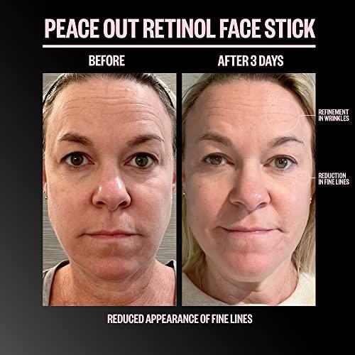 PEACE OUT PEACE OUT Skincare Retinol Face Stick. Reduce Fine Lines, Wrinkles and Uneven Texture with 3% Encapsulated Retinol (.28 oz)