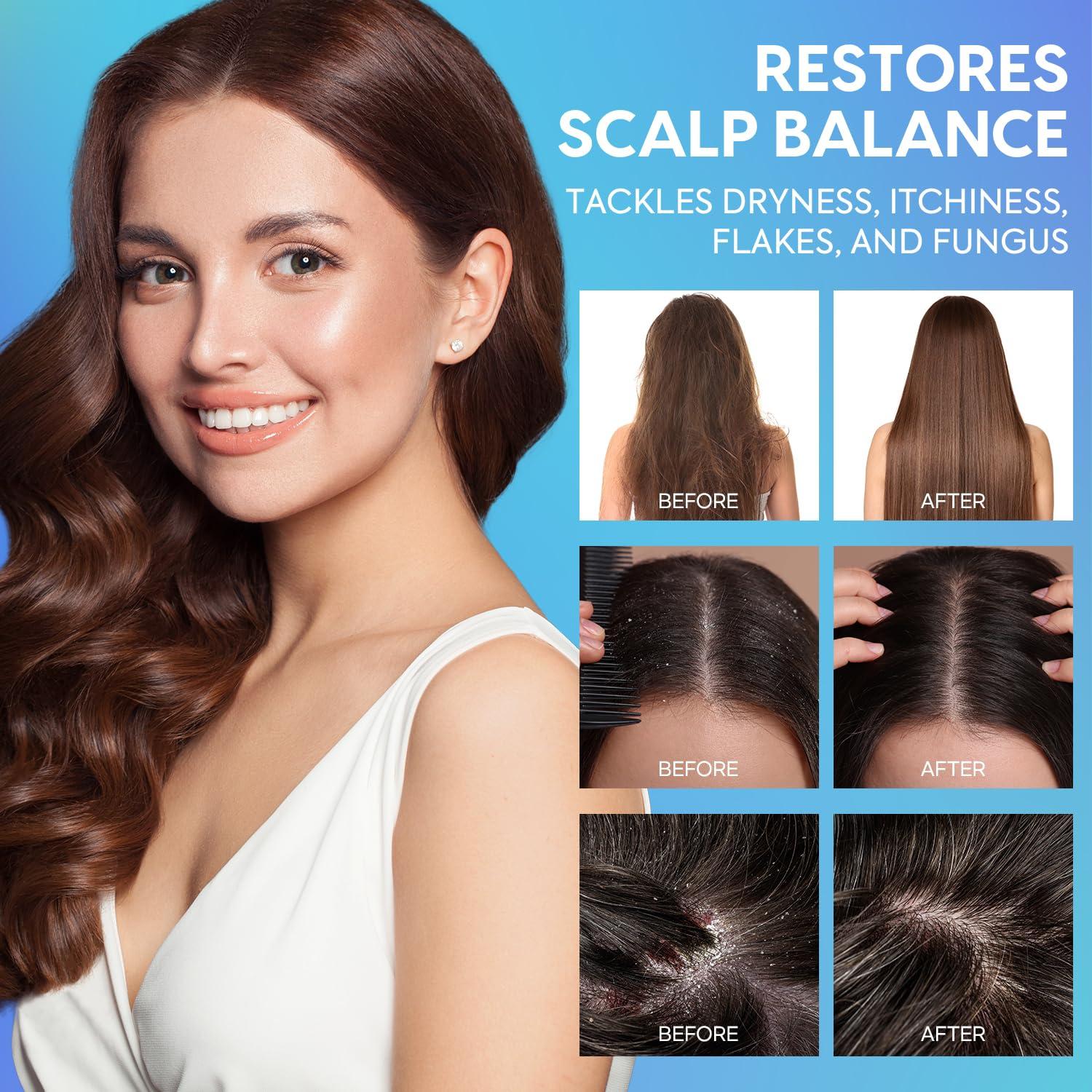 ProBliva Dandruff Hair & Dry Scalp Conditioner: Deep Moisturizing & Soothing Relief with Natural Ingredients - Calms Itch Fungus Flakes, 10 fl. oz.