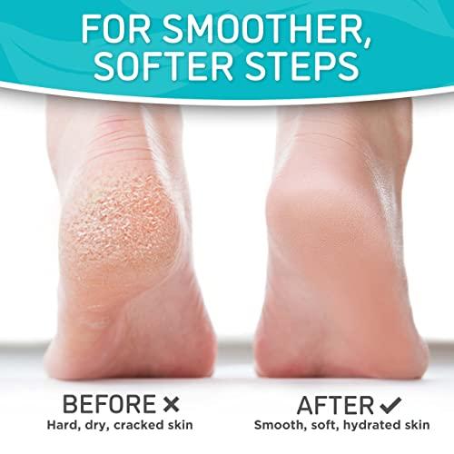 Soft Touch Soft Touch Foot Peel Mask - Pack of 2 Feet Peeling Masks for Dry, Cracked Heels & Calluses - Exfoliating Foot Mask Peel for Baby Soft Skin, Peppermint