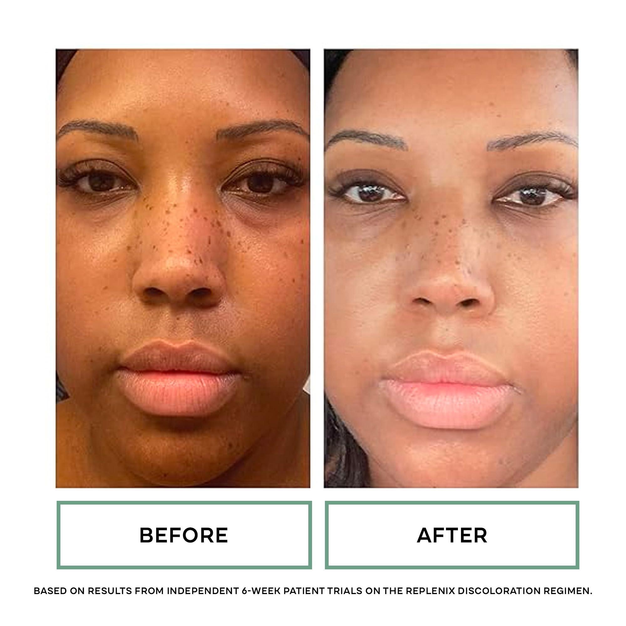 Replenix Replenix Vitamin C Pro Collagen Serum, Brightening Anti-Aging Face Treatment with Medical-Grade Antioxidants for Skin Discoloration (0.24 fl oz)