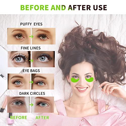Treondexir Under Eye Patches, Eye Masks 70PCS, Eye Patches for Puffy Eyes, Under Eye Mask Dark Circles and Puffiness w/Collagen, Green Tea, Aloe Vera for Puffy Eyes Treatment, Eye Bags Treatment for Women Men