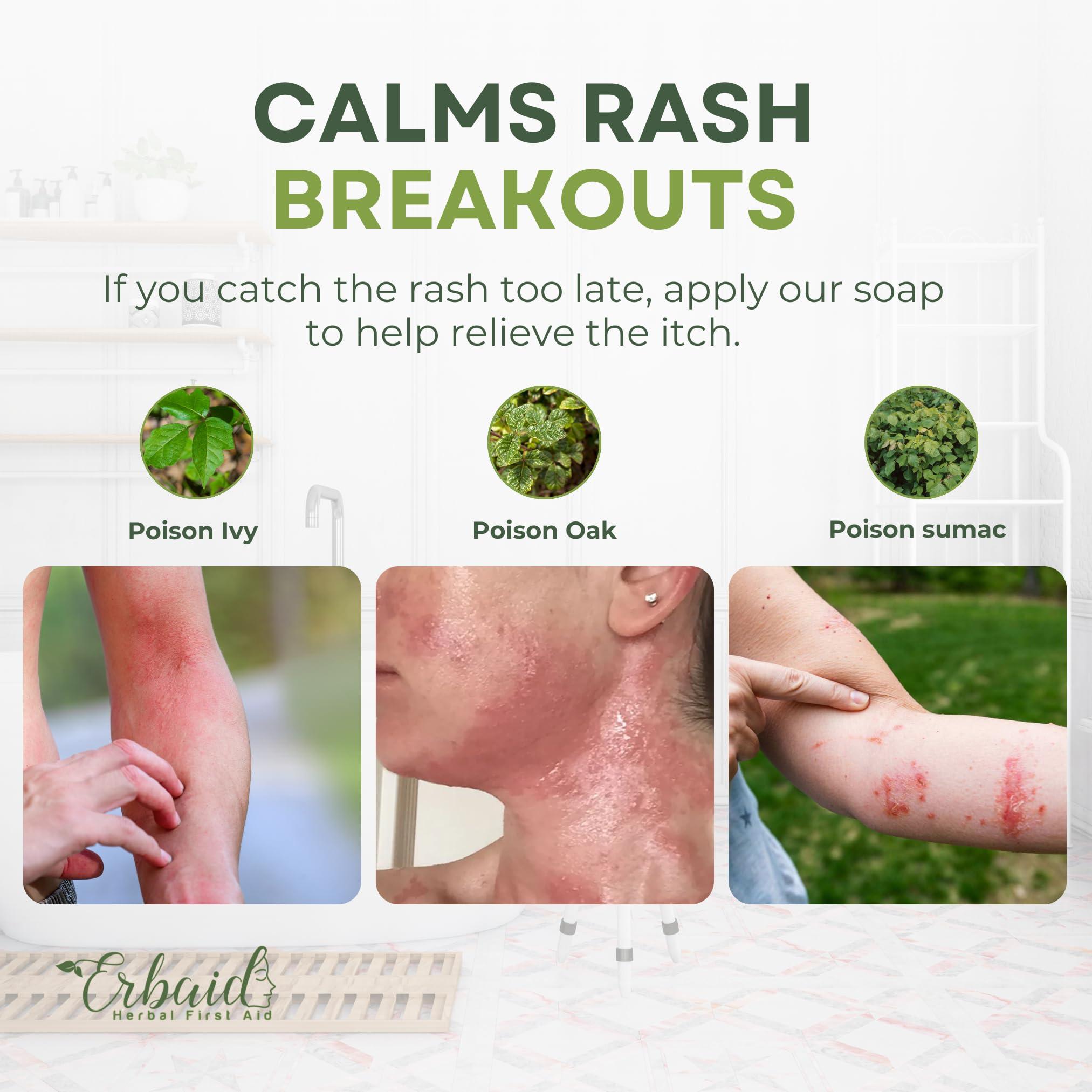 Erbaid Poison Ivy Soap Bar All Natural Poison Ivy Treatment Anti-Itch Skin Cleanser Wash for Poison Ivy, Poison Oak & Sumac Removes Oils, Soothes & Relieves Rashes 5oz Jewelweed Soap Made in USA