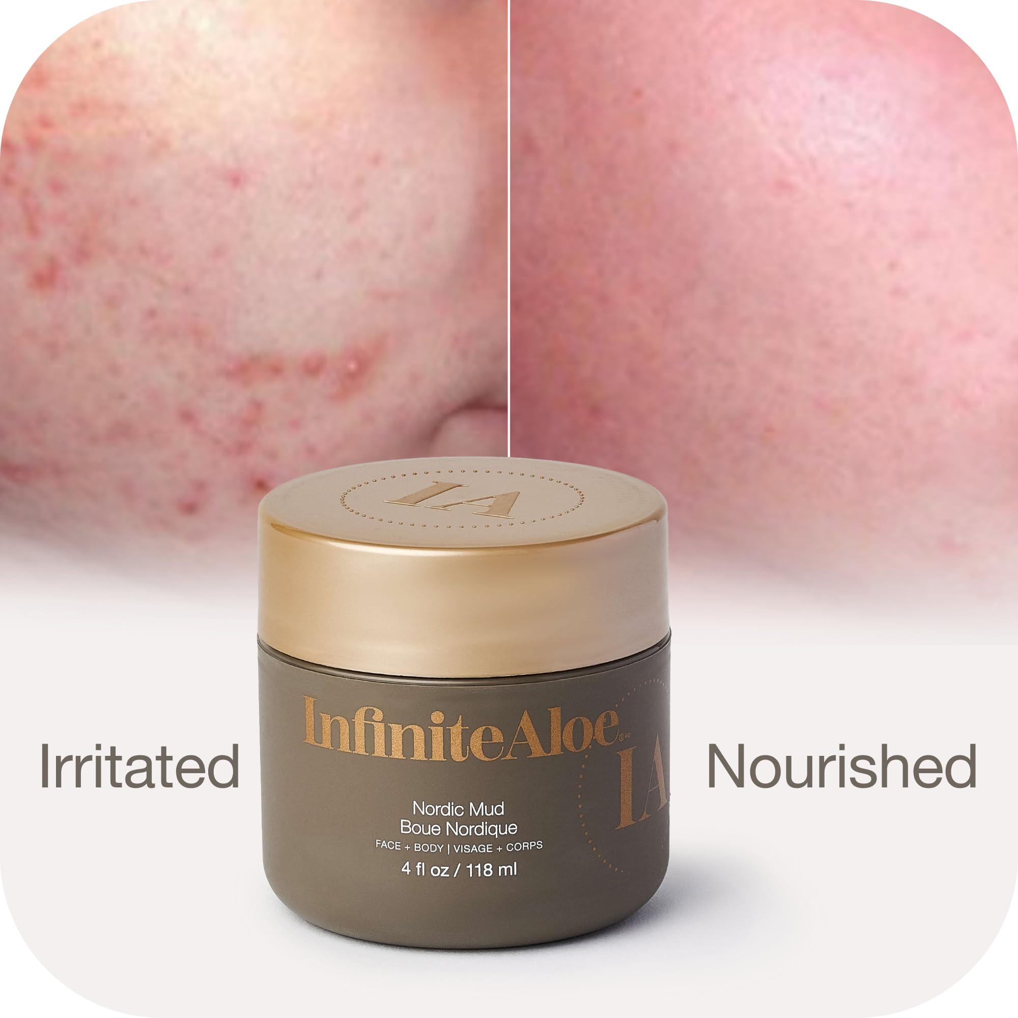 InfiniteAloe InfiniteAloe Nordic Mud Face Mask Skin Care Treatment, Peat + Charcoal + Aloe Vera + HA Combined, Suitable for All Skin Types - 4oz.