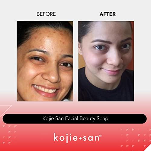Kojie San, Skin Science Kojie San Skin and Body Soap Original Kojic Acid, Dark Spot Remover Soap Bar with Coconut & Tea Tree Oil 3 x 65g Bars