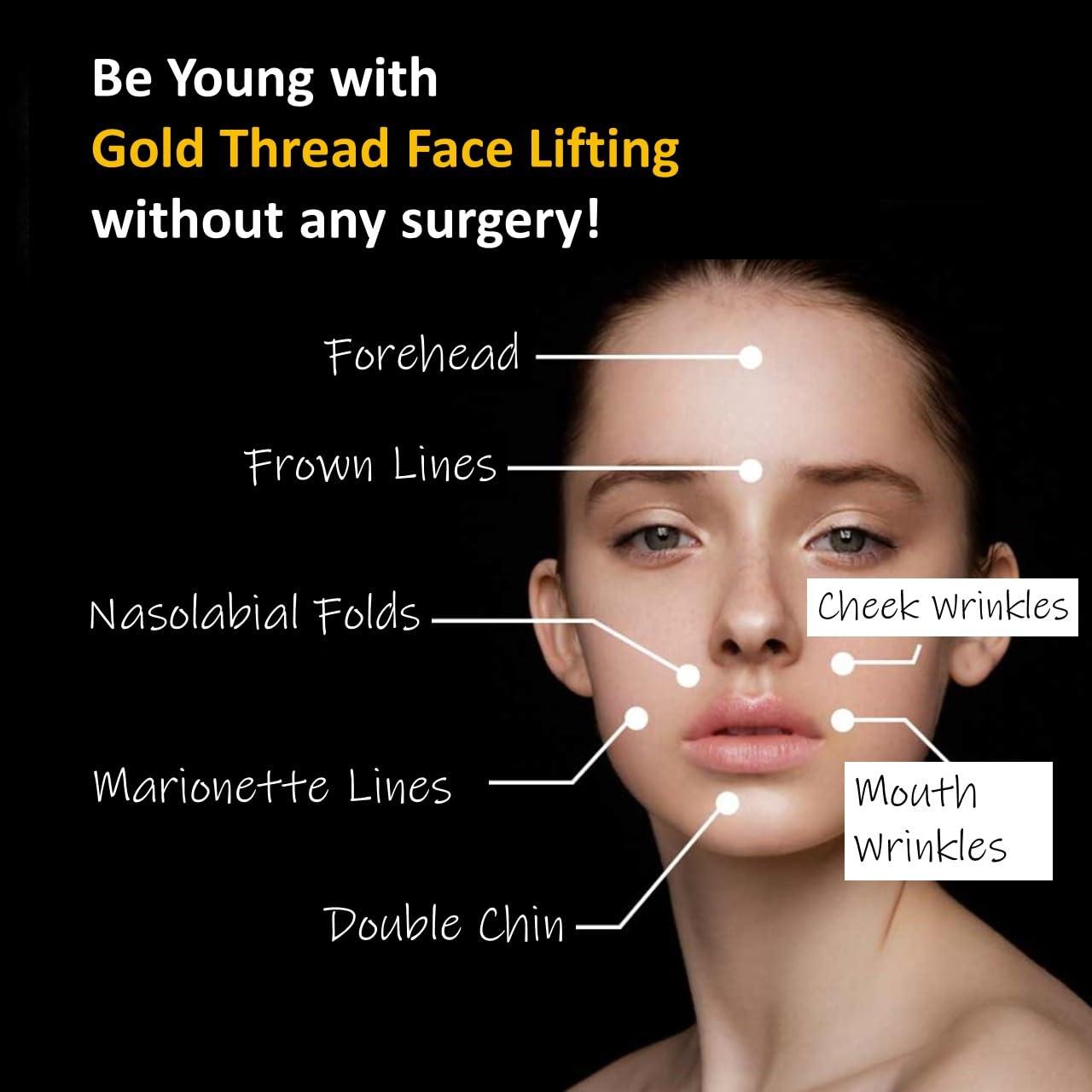 Generic HYUNSEOK 24K 99.99% Gold Threads for Face Lift/Smothing of Wrinkles/Long-Lasting Skin Rejuvenation and Firming for Body and Face Lifting 10PCS (KIM05 30G 13mm)