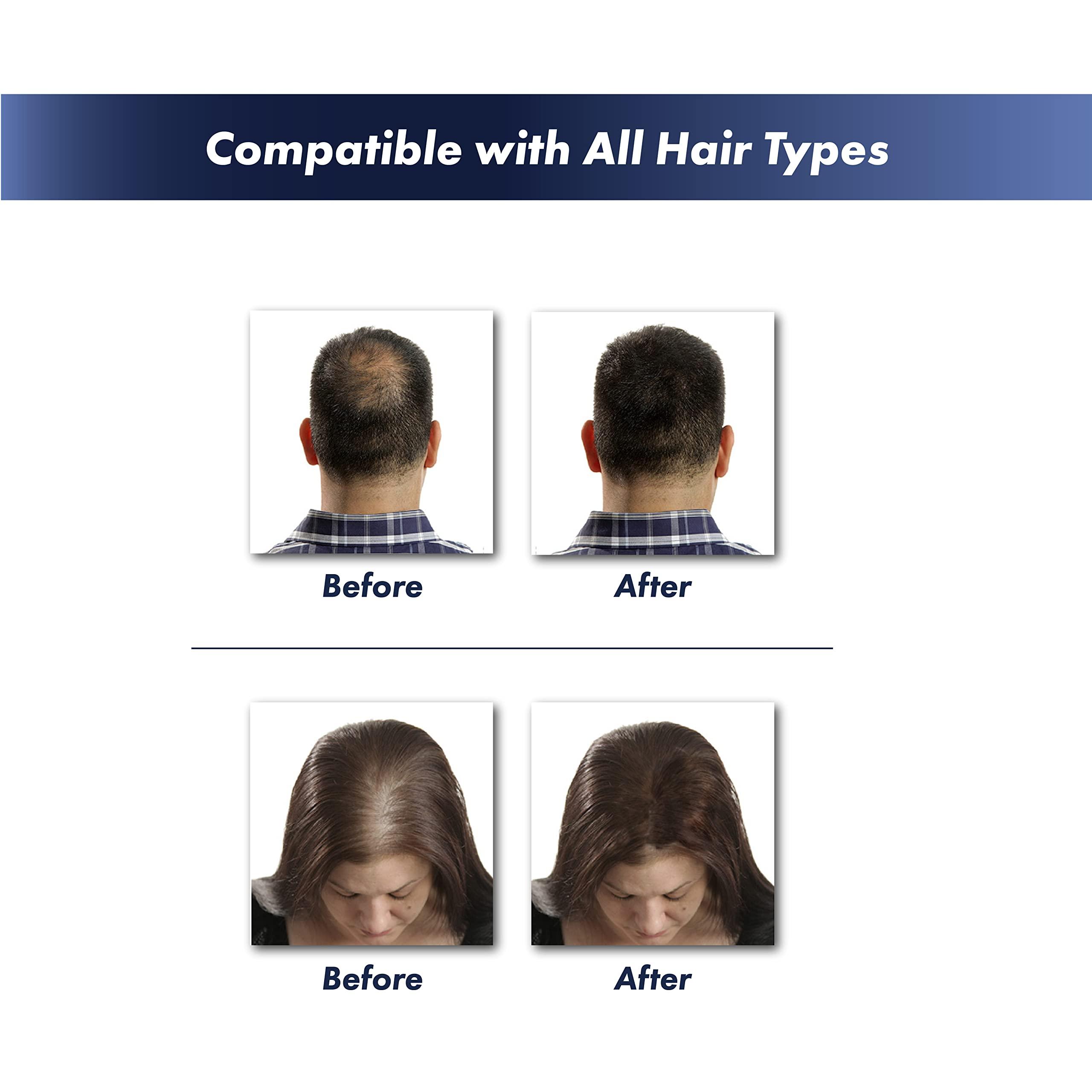 KeraFiber KeraFiber Professional Hair Building Fibres - Natural Keratin Hair thickener Fibres, Hair Powder for Men and Women, Full Head of Hair in 30 Seconds-Hair Fibres Auburn (28g/0.98oz)