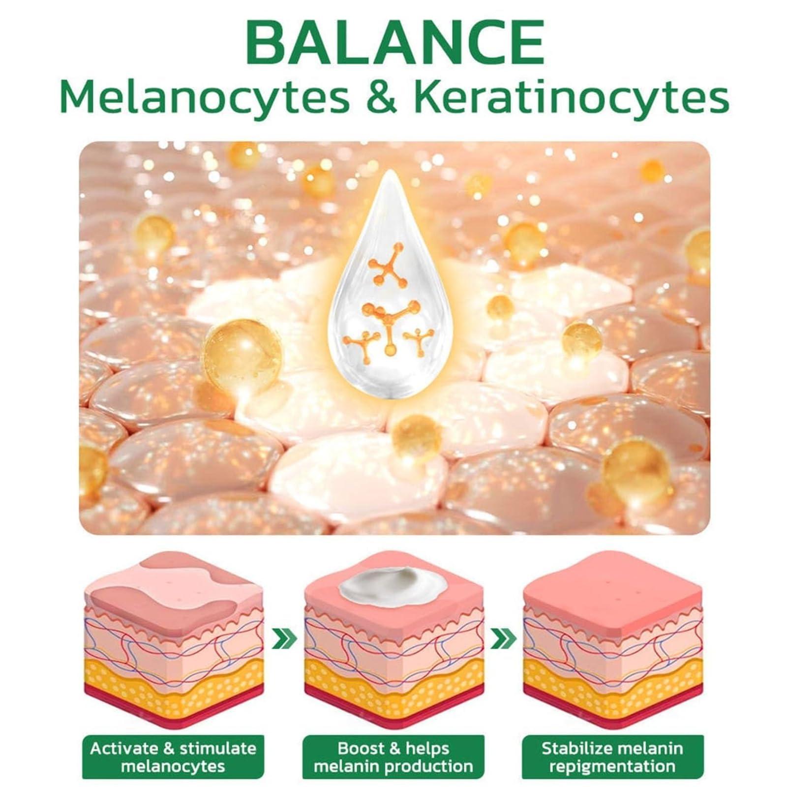 EXQST Vitiligo Fix Revitalize Elixir,2023 New Vitiligo Treatment Cream,Vitiligo Soothing Cream,Moisturizer Cream For Skin Vitiligo,Vitiligo Care Cream For Reduce White Spot