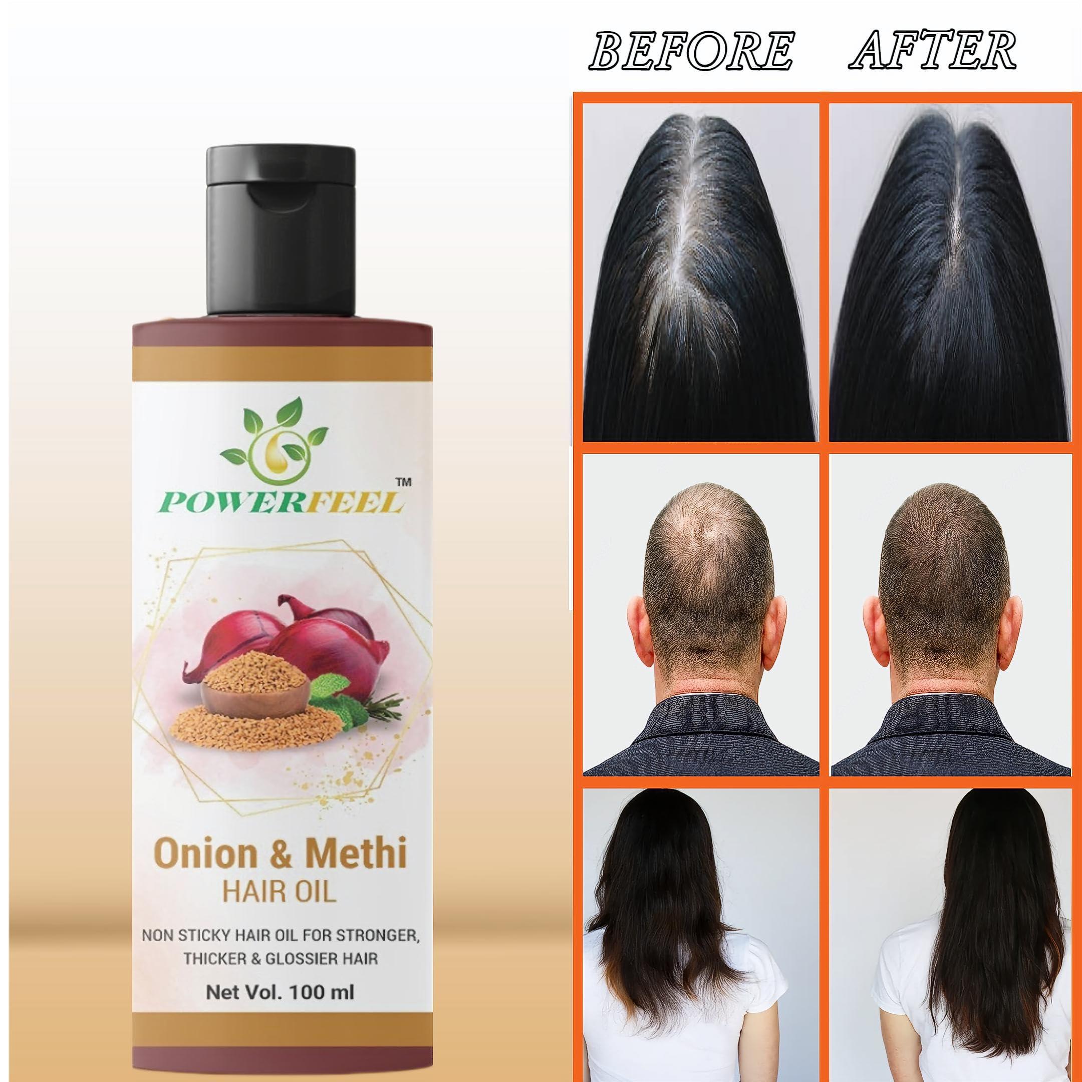 POWERFEEL POWERFEEL, Hair Oil For Stronger, Thicker & Glossier Hair- 100ml (Pack of 3)