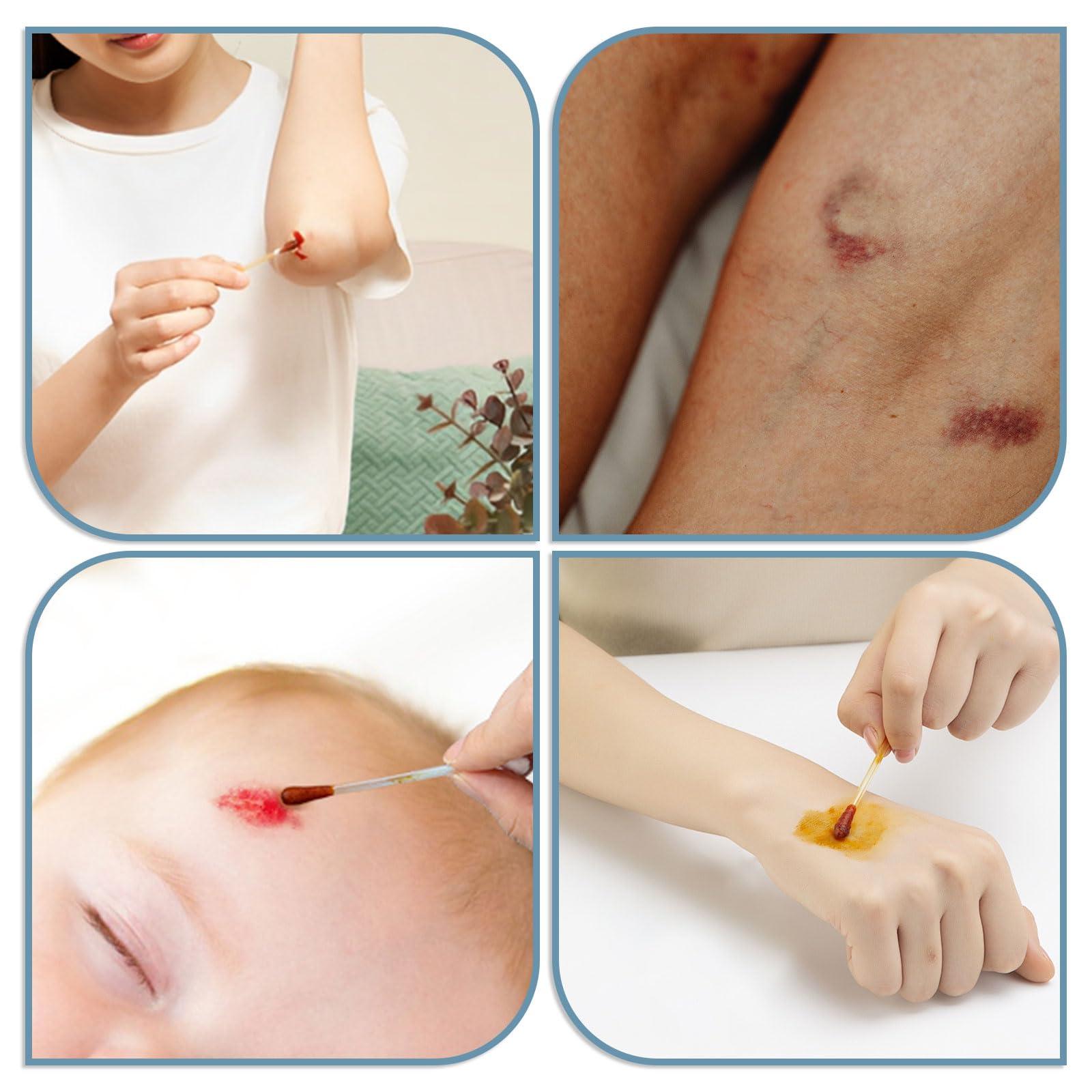 RSQAZQ Disposable Iodine Cotton Swabs, Individually Wrapped Medical Iodophor Swabsticks Bulk, Povidone Wound Iodine Qtips Cotton Buds First Aid Kits for Nasal Ears Bruise Care, Travel Outdoor (White 400)