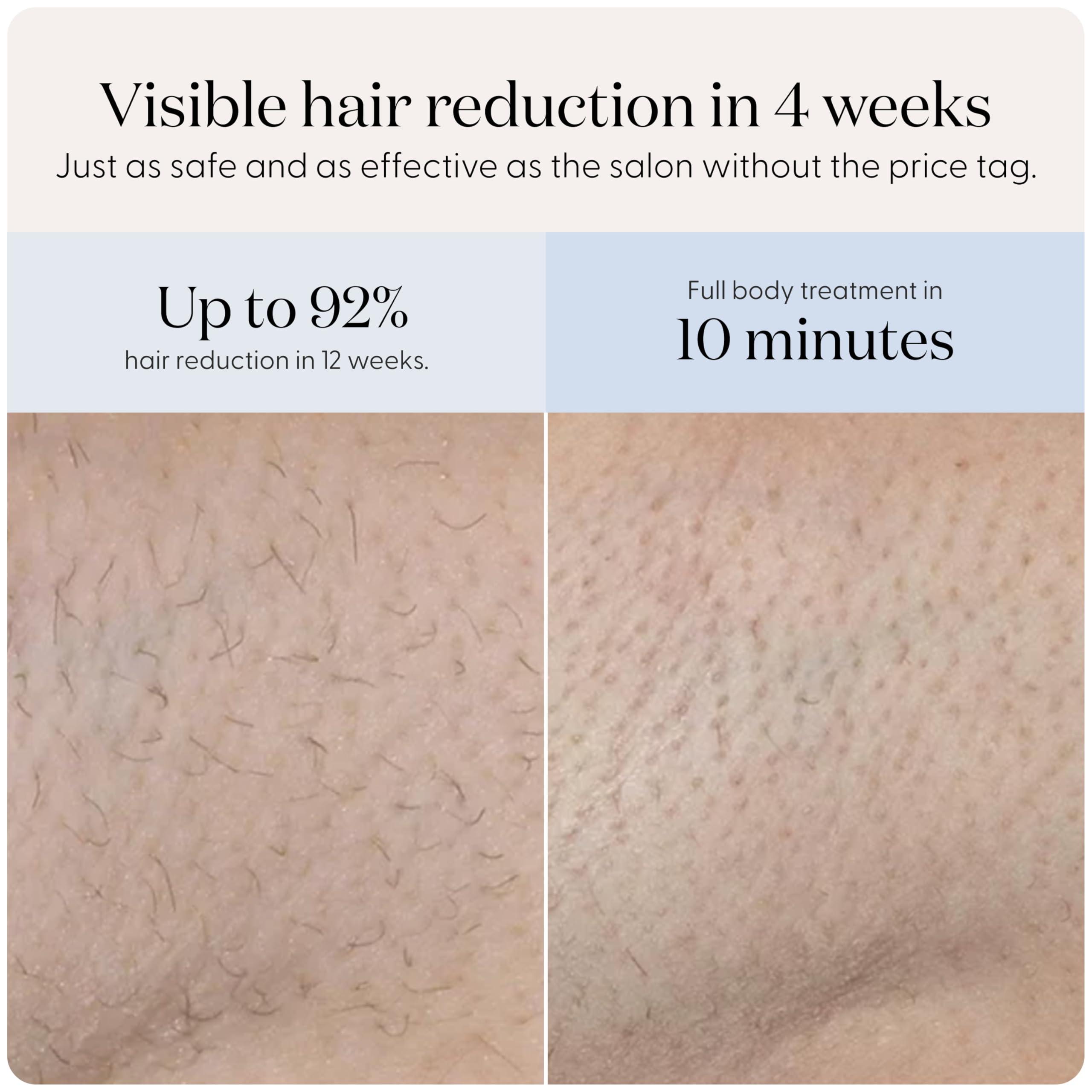 SMOOTHSKIN Smoothskin Pure Mini Lite Lilac IPL Laser Hair Removal Device, Long-Lasting Body, Bikini, Facial Hair Removal, Alternative to Laser & Bikini Shaver