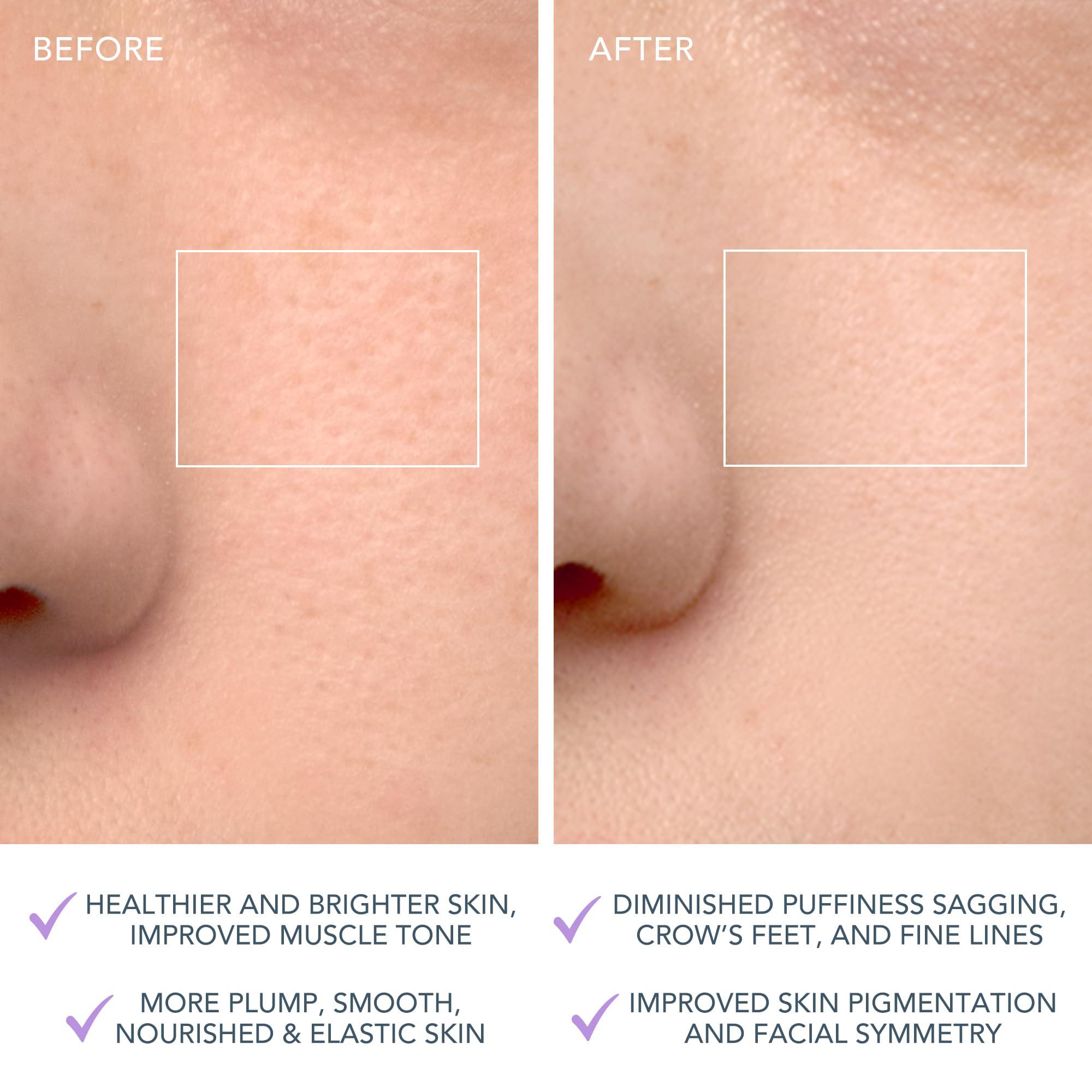 FOREO FOREO LUNA 4 Face Cleansing Brush - Firming Face Massager - Anti Aging Care - Enhances Absorption - Simple Skin Care Tools - Sensitive Skin