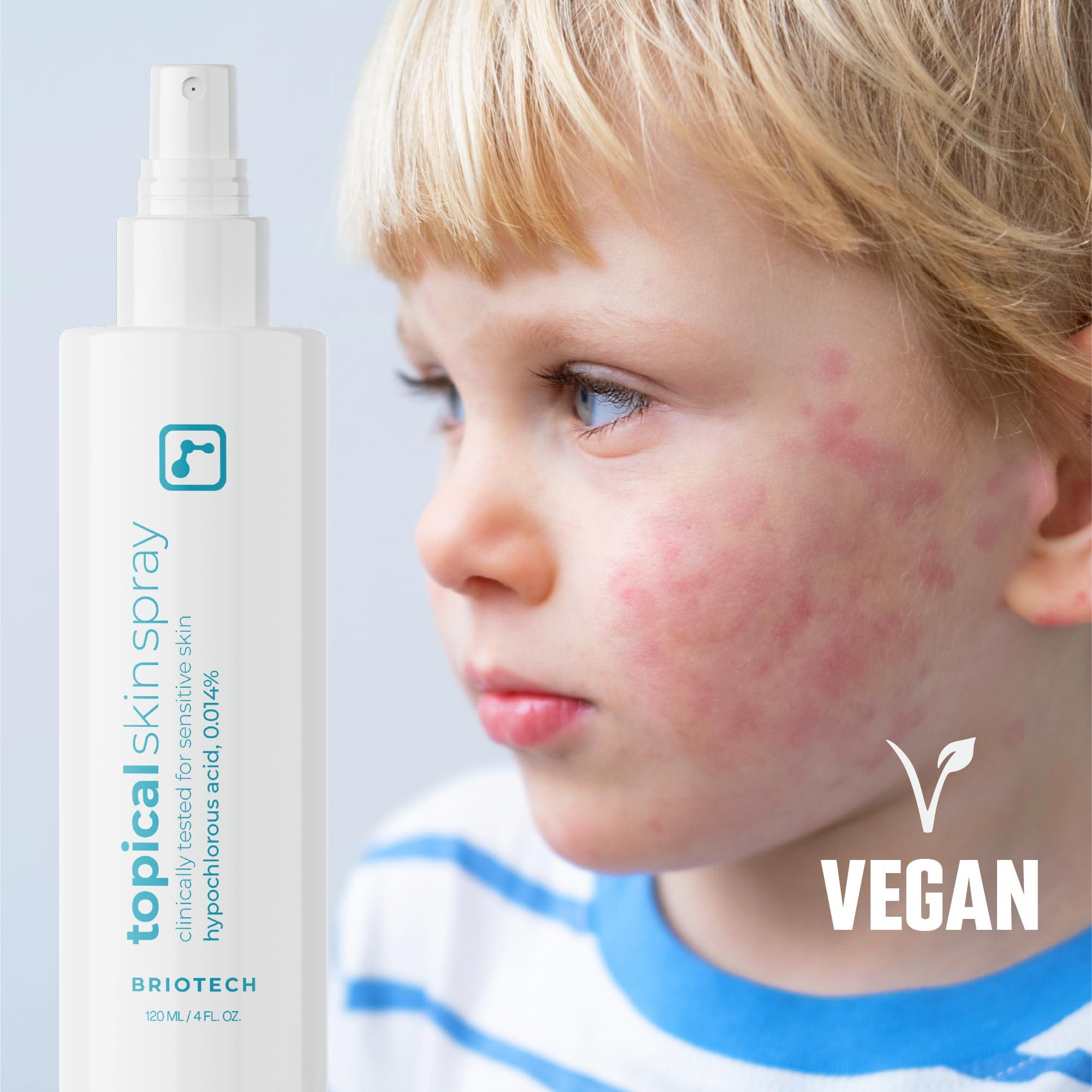BRIOTECH BRIOTECH Topical Skin Spray, Hypochlorous Acid Spray for Body & Face, Eyelid Cleanser, HOCl Facial Mist, Support Against Irritation, Calm Redness, Soothe Scalp, Packaging May Vary, 4 oz ea, 2 ct