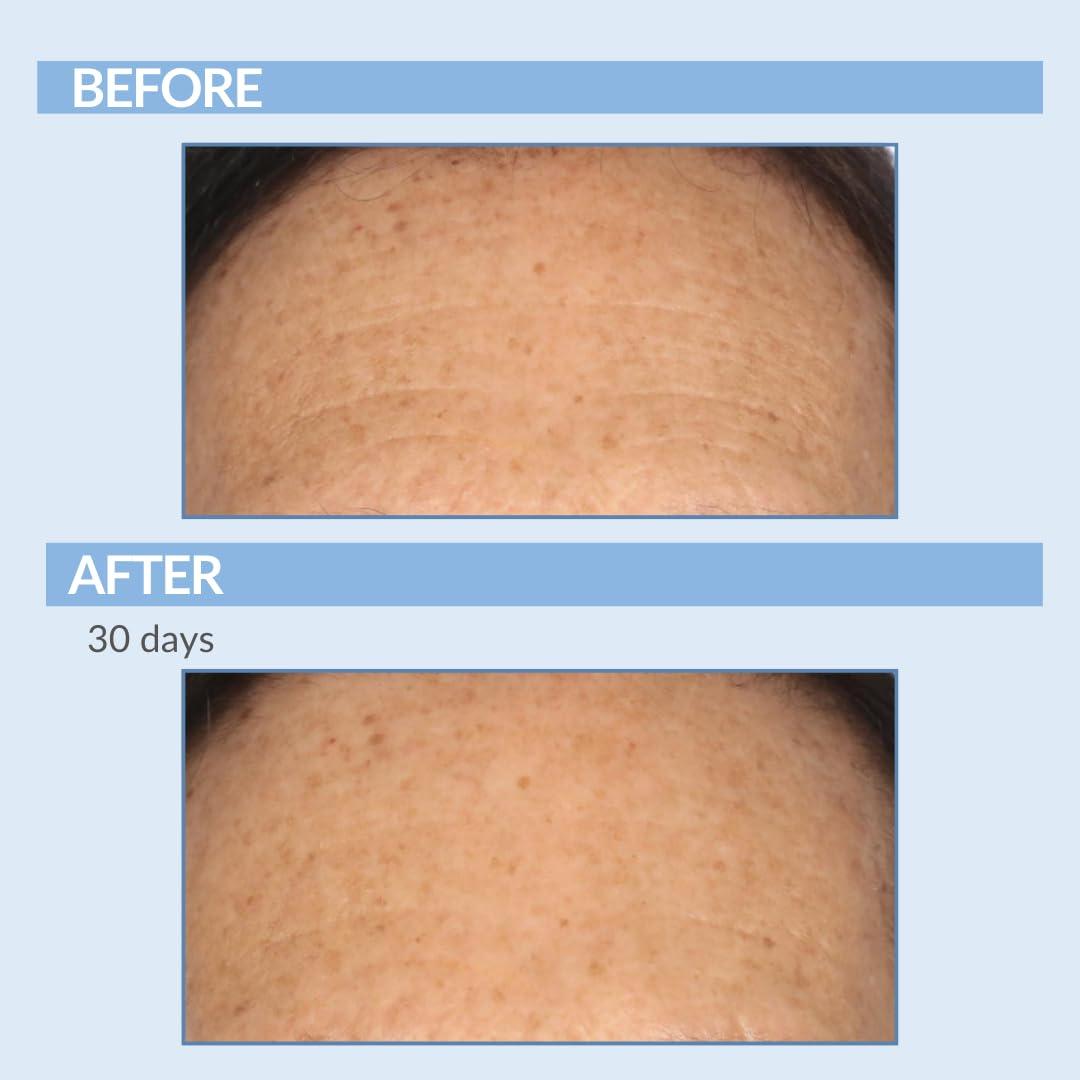 Serious Skincare Serious Skincare Retinol Facial Care DUO - A Force XR Serum Concentrate & A Cream XR Moisture Cream for Face - With Vitamin C - Anti-Aging for Lines, Wrinkles - Resurfaces and Hydrates Skin