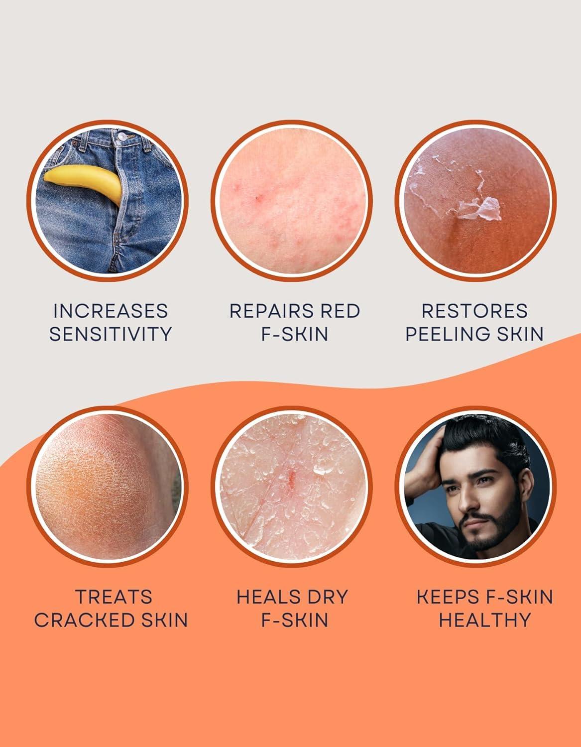 CAUSEHUMAN CAUSEHUMAN Penile heal cream for phimosis, redness, dryness, and scarring of skin | Prevents Irritation | Phimosis Cream | Restores and Moisturizes skin | 100 ml (3.38 fl oz) | 60 days supply