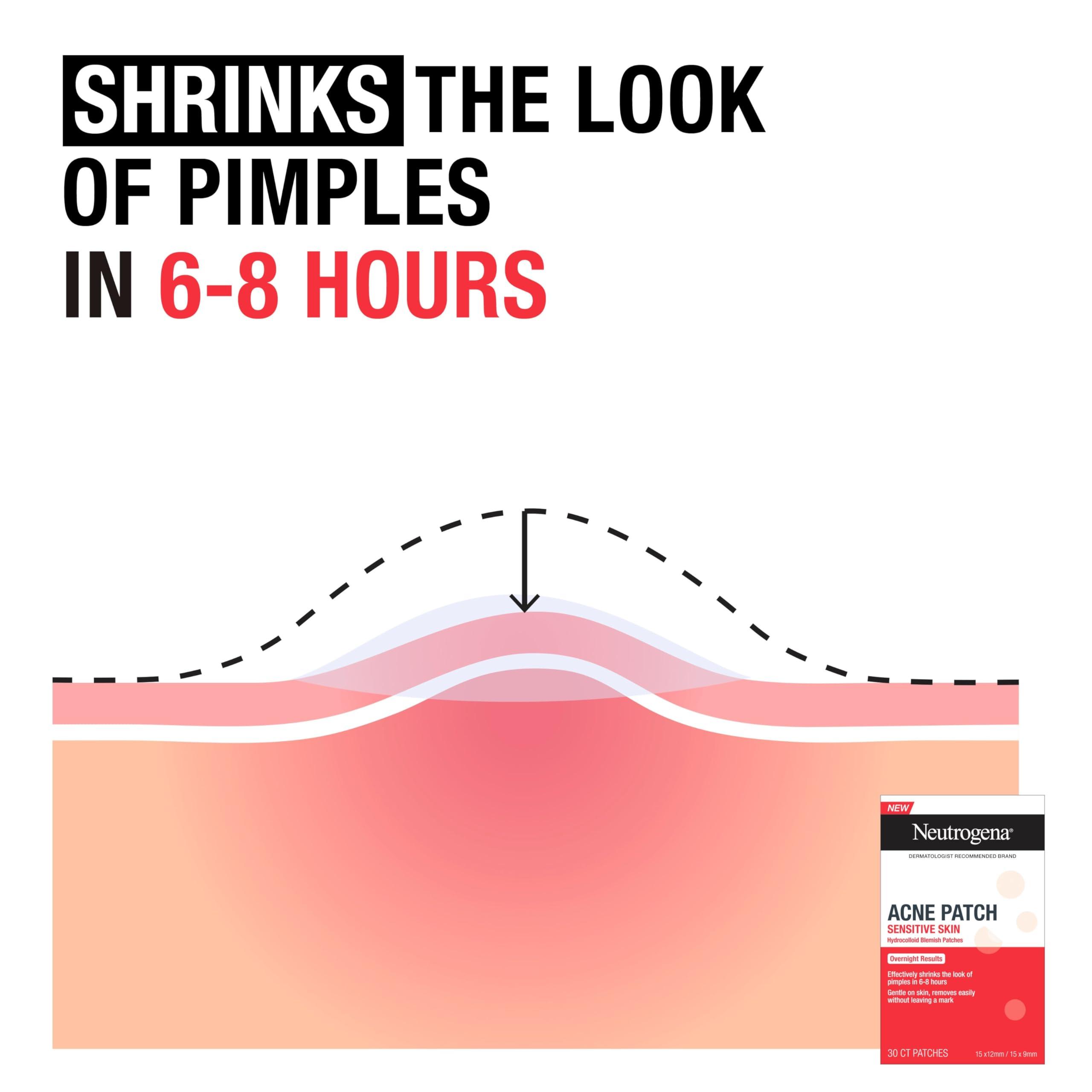 Neutrogena Neutrogena Pimple Patches for Sensitive Skin Variety Pack, Hydrocolloid Blemish Acne Patches Shrink the Look of Pimples & Zits Overnight, Gentle, Non-Medicated Facial Patches, Two Sizes, 30 ct