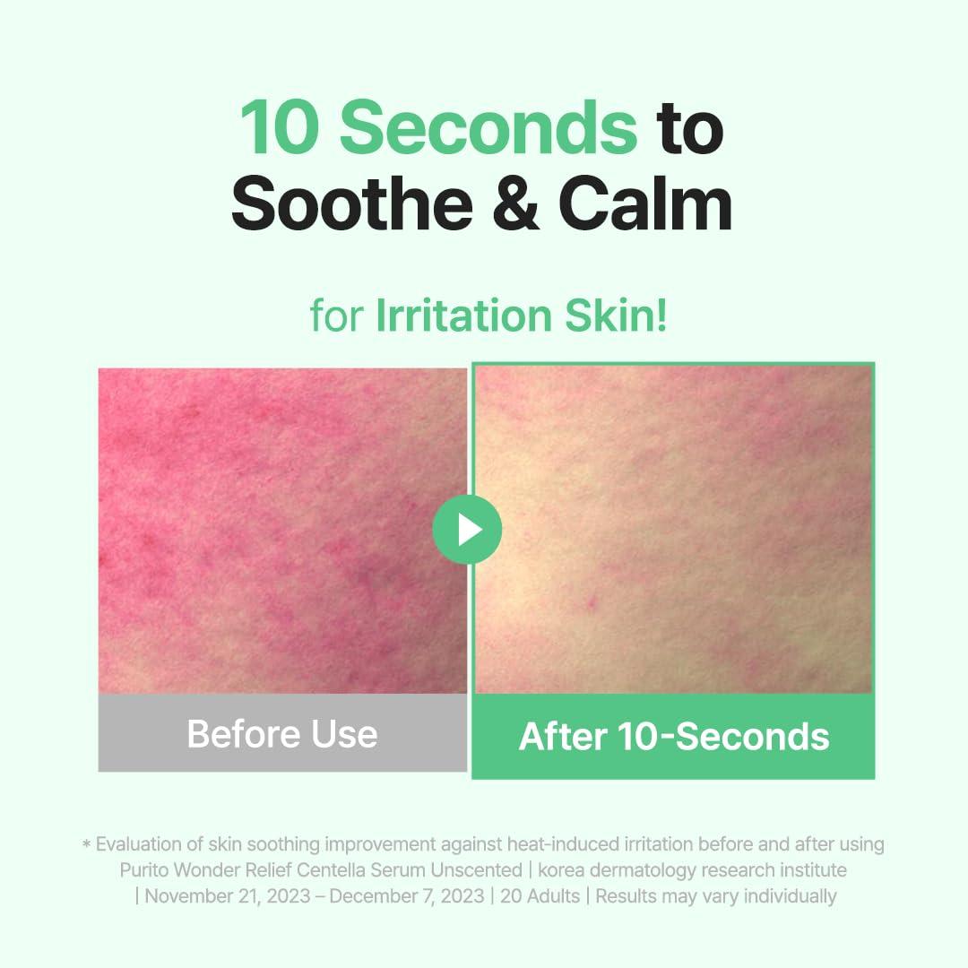 PURITO PURITO Centella Unscented Serum, Korean Centella, for All Skin Types, Ampoule, Soothing, Calming, Facial Serum for face, Vegan & Cruelty-Free, Korean Skin Care, 60ml 2fl.oz