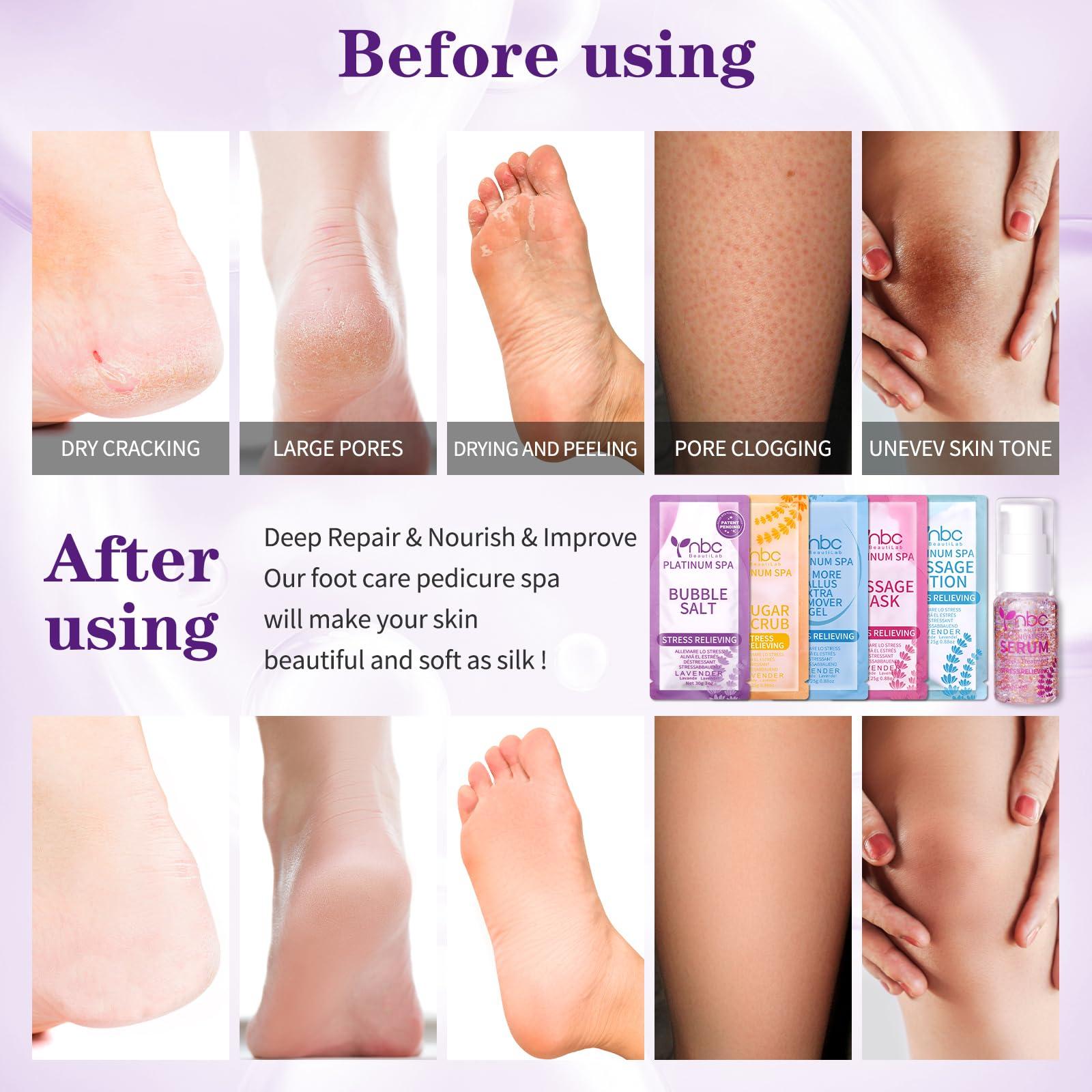 nbc BeautiLab nbc BeautiLab Pedicure Foot Soak Set - Upgraded 6 in 1 Foot Spa, Foot Bath Spa, Pedicure Kit for Tired & Dry Cracked Feet, Athletes Feet, Bad Odor, Softens Calluses (3 Set Lavender)